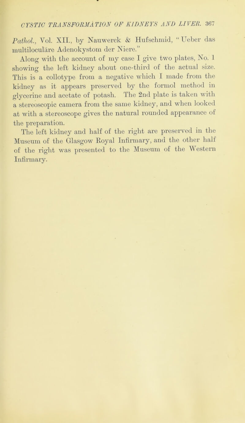 Pathol., Vol. XII., by Nauwerck & Hufschmid, “ Ueber das inultiloculare Adenokystom der Niere.” Along with the account of my case I give two plates, No. 1 showing the left kidney about one-third of the actual size. This is a collotype from a negative which I made from the kidney as it appears preserved by the formol method in glycerine and acetate of potash. The 2nd plate is taken with a stereoscopic camera from the same kidney, and when looked at with a stereoscope gives the natural rounded appearance of the preparation. The left kidney and half of the right are preserved in the Museum of the Glasgow Royal Infirmary, and the other hall of the right was presented to the Museum of the Western Infirmary.