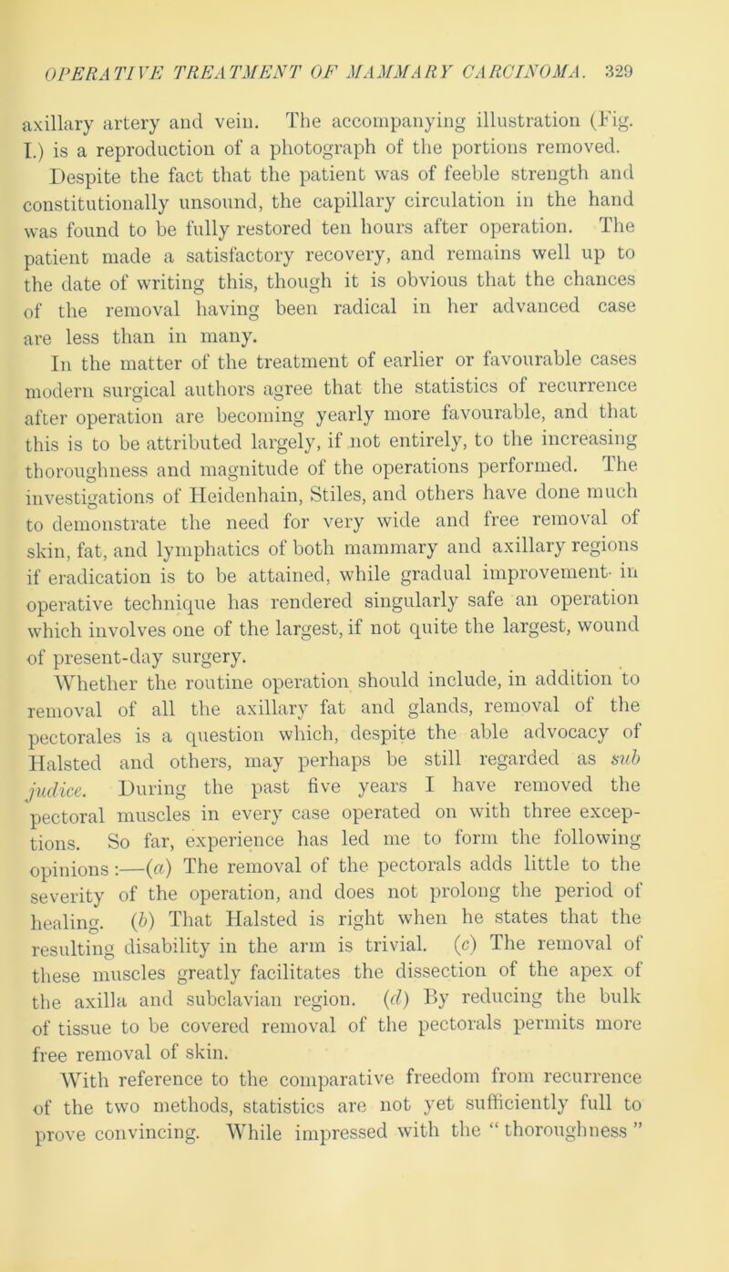 axillary artery and vein. The accompanying illustration (Fig. I.) is a reproduction of a photograph of the portions removed. Despite the fact that the patient was of feeble strength and constitutionally unsound, the capillary circulation in the hand was found to be fully restored ten hours after operation. The patient made a satisfactory recovery, and remains well up to the date of writing this, though it is obvious that the chances of the removal having been radical in her advanced case are less than in many. In the matter of the treatment of earlier or favourable cases modern surgical authors agree that the statistics of recurrence after operation are becoming yearly more favourable, and that this is to be attributed largely, if not entirely, to the increasing thoroughness and magnitude of the operations performed. The investigations of Heidenhain, Stiles, and others have done much to demonstrate the need for very wide and free removal of skin, fat, and lymphatics of both mammary and axillary regions if eradication is to be attained, while gradual improvement- in operative technique has rendered singularly safe an operation which involves one of the largest, if not quite the largest, wound of present-day surgery. Whether the routine operation should include, in addition to removal of all the axillary fat and glands, removal of the pectorales is a question which, despite the able advocacy of Halsted and others, may perhaps be still regarded as sub judice. During the past five years I have removed the pectoral muscles in every case operated on with three excep- tions. So far, experience has led me to form the following opinions:—(a) The removal of the pectorals adds little to the severity of the operation, and does not prolong the period of healing. (b) That Halsted is right when he states that the resulting disability in the arm is trivial, (c) The removal of these muscles greatly facilitates the dissection of the apex of the axilla and subclavian region, (d) By reducing the bulk of tissue to be covered removal of the pectorals permits more free removal of skin. With reference to the comparative freedom from recurrence of the two methods, statistics are not yet sufficiently full to prove convincing. While impressed with the “ thoroughness ”