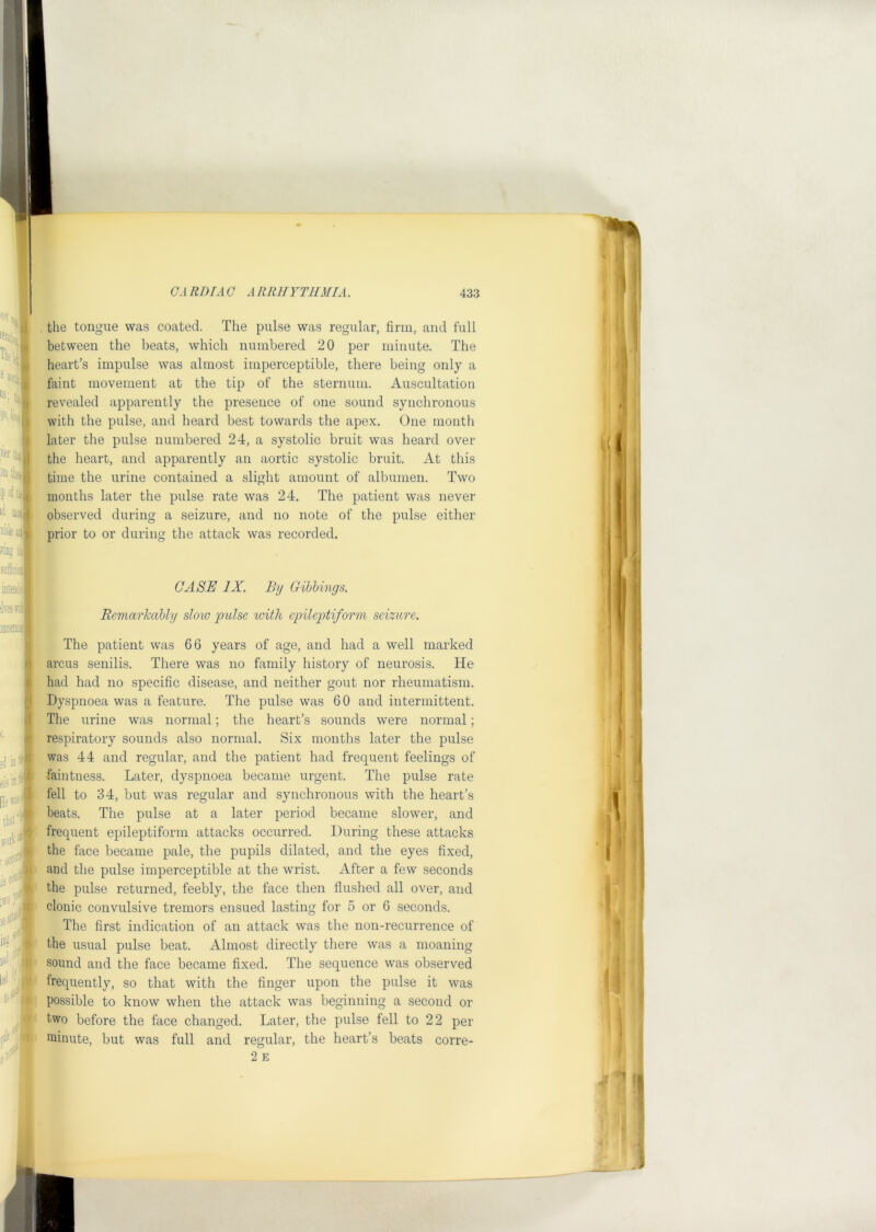 the tongue was coated. The pulse was regular, firm, and full between the beats, which numbered 20 per minute. The heart’s impulse was almost imperceptible, there being only a faint movement at the tip of the sternum. Auscultation revealed apparently the presence of one sound synchronous with the pulse, and heard best towards the apex. One month later the pulse numbered 24, a systolic bruit was heard over the heart, and apparently an aortic systolic bruit. At this time the urine contained a slight amount of albumen. Two months later the pulse rate was 24. The patient was never observed during a seizure, and no note of the pulse either prior to or during the attack was recorded. CASE IX. By Gibbings. Remarkably slow pulse loith epileptiform seizure. The patient was 66 years of age, and had a well marked arcus senilis. There was no family history of neurosis. He had had no specific disease, and neither gout nor rheumatism. Dyspnoea was a feature. The pulse was 60 and intermittent. The urine was normal; the heart’s sounds were normal; respiratory sounds also normal. Six months later the pulse was 44 and regular, and the patient had frequent feelings of faintness. Later, dyspnoea became urgent. The pulse rate fell to 34, but was regular and synchronous with the heart’s beats. The pulse at a later period became slower, and frequent epileptiform attacks occurred. During these attacks the face became pale, the pupils dilated, and the eyes fixed, and the pulse imperceptible at the wrist. After a few seconds the pulse returned, feebly, the face then flushed all over, and clonic convulsive tremors ensued lasting for 5 or 6 seconds. The first indication of an attack was the non-recurrence of the usual pulse beat. Almost directly there was a moaning sound and the face became fixed. The sequence was observed frequently, so that with the finger upon the pulse it was possible to know when the attack was beginning a second or two before the face changed. Later, the pulse fell to 22 per minute, but was full and regular, the heart’s beats corre- 2 E