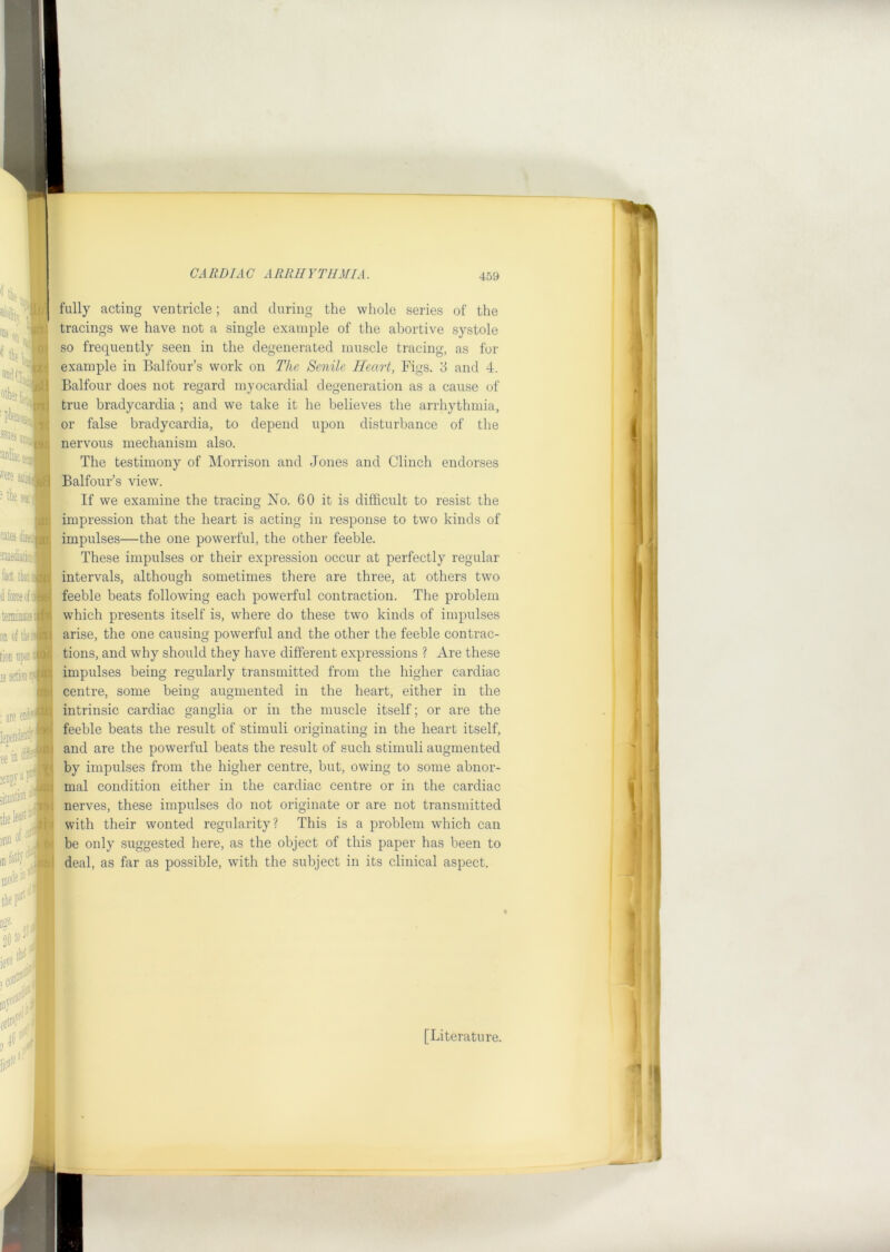 :'s. . fjii - '.[li r.r. ^ k 0^ IX i :nl\ :aiact. «re at: ^ the sv .lUi cites !riie&. i tact thii;Jjxi dke({-’9&; termini:- Hvi on of the:'ni tioD uponioi; IS action rjctt fiS! I ’ t f f. ; are enu-.' lependeni; •ee. in dS ^yj >ai iV Jill thelea^'■ ^ orni of '■ m fi^k'V fully acting ventricle; and during the whole series of the tracings we have not a single example of the abortive systole so frequently seen in the degenerated muscle tracing, as for example in Balfour’s work on The Senile Heart, Figs. 3 and 4. Balfour does not regard myocardial degeneration as a cause of true bradycardia ; and we take it he believes the arrhythmia, or false bradycardia, to depend upon disturbance of the nervous mechanism also. The testimony of Morrison and Jones and Clinch endorses Balfour’s view. If we examine the tracing Xo. 60 it is difficult to resist the impression that the heart is acting in response to two kinds of impulses—the one powerful, the other feeble. These impulses or their expression occur at perfectly regular intervals, although sometimes there are three, at others two feeble beats following each powerful contraction. The problem which presents itself is, where do these two kinds of impulses arise, the one causing powerful and the other the feeble contrac- tions, and why should they have different expressions ? iVre these impulses being regularly transmitted from the higher cardiac centre, some being augmented in the heart, either in the intrinsic cardiac ganglia or in the muscle itself; or are the feeble beats the result of stimuli originating in the heart itself, and are the powerful beats the result of such stimuli augmented by impulses from tbe higher centre, but, owing to some abnor- mal condition either in the cardiac centre or in the cardiac nerves, these impulses do not originate or are not transmitted with their wonted regularity? This is a problem which can be only suggested here, as the object of this paper has been to deal, as far as possible, with the subject in its clinical aspect. thepjri [Literature.