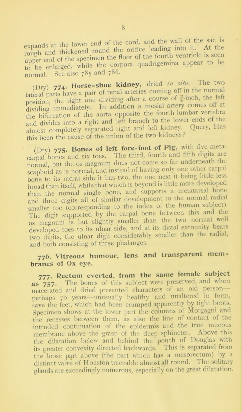 j t ,up lower end of the cord, and the wall of the sac is eXPlh nnd thickened round the orifice leading into it. At the upper end of the specimen the floor of the fourth ventricle is seen to be enlarged, while the corpora quadrigemina appear to be normal. See also 785 and 786. (Dry) 774. Horse = shoe kidney, dried >« situ. 1 he two lateral parts have a pair of renal arteries coming off in the norma position, the right one dividing after a course of f-inch, the left dividing immediately. In addition a mesial artery comes off at the bifurcation of the aorta opposite the fourth lumbar vertebra and divides into a right and left branch to the lower ends of the almost completely separated right and left kidney Query, Has this been the cause of the union of the two kidneys? (Dry) 775. Bones of left fore-foot of Pig, with five meta- carpal bones and six toes. The third, fourth and fifth digits aie normal, but the os magnum does not come so far underneath the scaphoid as is normal, and instead of having only one other carpal bone to its radial side it has two, the one next it being little less broad than itself, while that which is beyond is little more developed than the normal single bone, and supports a metatarsal bone and three digits all of similar development to the normal radial smaller toe (corresponding to the index ol the human subject). The digit supported by the carpal bone between this and the os magnum is but slightly smaller than the two normal well developed toes to its ulnar side, and at its distal extremity bears two digits, the ulnar digit considerably smaller than the radial, and both consisting of three phalanges. 776. Vitreous humour, lens and transparent mem branes of Ox eye. ■777. Rectum everted, from the same female subject as 757. The bones of this subject were preserved, and when macerated and dried presented characters of an old person— perhaps 70 years—unusually healthy and unaltered in form, save the feet, which had been cramped apparently by tight boots. Specimen shows at the lower part the columns ol Morgagni and the recesses between them, as also the line of contact of the intruded continuation of the epidermis and the true mucous membrane above the grasp of the deep sphincter. Above this the dilatation below and behind the pouch of Douglas with its greater convexity directed backwards. This is separated from the loose part above (the part which has a mesorectum) by a distinct valve of Houston traceable almost all round. 1 be solitary glands are exceedingly numerous, especially on the great dilatation.