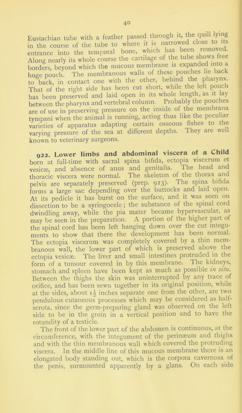 Eustachian tube with a feather passed through it, the qudl tying in the course of the tube to where it is narrow e c ose o entrance into the temporal bone, which has een remove Along nearly its whole course the cartilage of the tube shows free borders, beyond which the mucous membrane is expanded into a huge pouch. The membranous walls of these pouches lie back to back, in contact one with the other, behind the pharynx. That of the right side has been cut short, while the left pouch has been preserved and laid open in its whole length, as it lay between the pharynx and vertebral column. Probably the pouches are of use in preserving pressure on the inside of the membrana tympani when the animal is running, acting thus like the peculiar varieties of apparatus adapting certain osseous fishes to the varying pressure of the sea at different depths. They are well known to veterinary surgeons. 922. Lower limbs and abdominal viscera of a Child born at full-time with sacral spina bifida, ectopia viscerum et vesicas, and absence of anus and genitalia. The head and thoracic viscera were normal. The skeleton of the thorax and pelvis are separately preserved (prep. 923). The spina bifida forms a large sac depending over the buttocks and laid open. At its pedicle it has burst on the surface, and it was seen on dissection to be a syringocele; the substance of the spinal cord dwindling away, while the pia mater became hypervascular, as may be seen in the preparation. A portion of the higher part of the spinal cord has been left hanging down over the cut integu- ments to show that there the development has been normal. The ectopia viscerum was completely covered by a thin mem- branous wall, the lower part of which is preserved above the ectopia vesicas. The liver and small intestines protruded in the form of a tumour covered in by this membrane. I he kidneys, stomach and spleen have been kept as much as possible in situ. Between the thighs the skin was uninterrupted by any trace of orifice, and has been sewn together in its original position, while at the sides, about ii inches separate one from the other, are two pendulous cutaneous processes which may be considered as hall- scrota, since the germ-preparing gland was observed on the left side to be in the groin in a vertical position and to have the rotundity of a testicle. The front of the lower part of the abdomen is continuous, at the circumference, with the integument of the perinasum and thighs and with the thin membranous wall which covered the protruding viscera. In the middle line of this mucous membrane there is an elongated body standing out, which is the corpora cavernosa of the penis, surmounted apparently by a glans. On each side