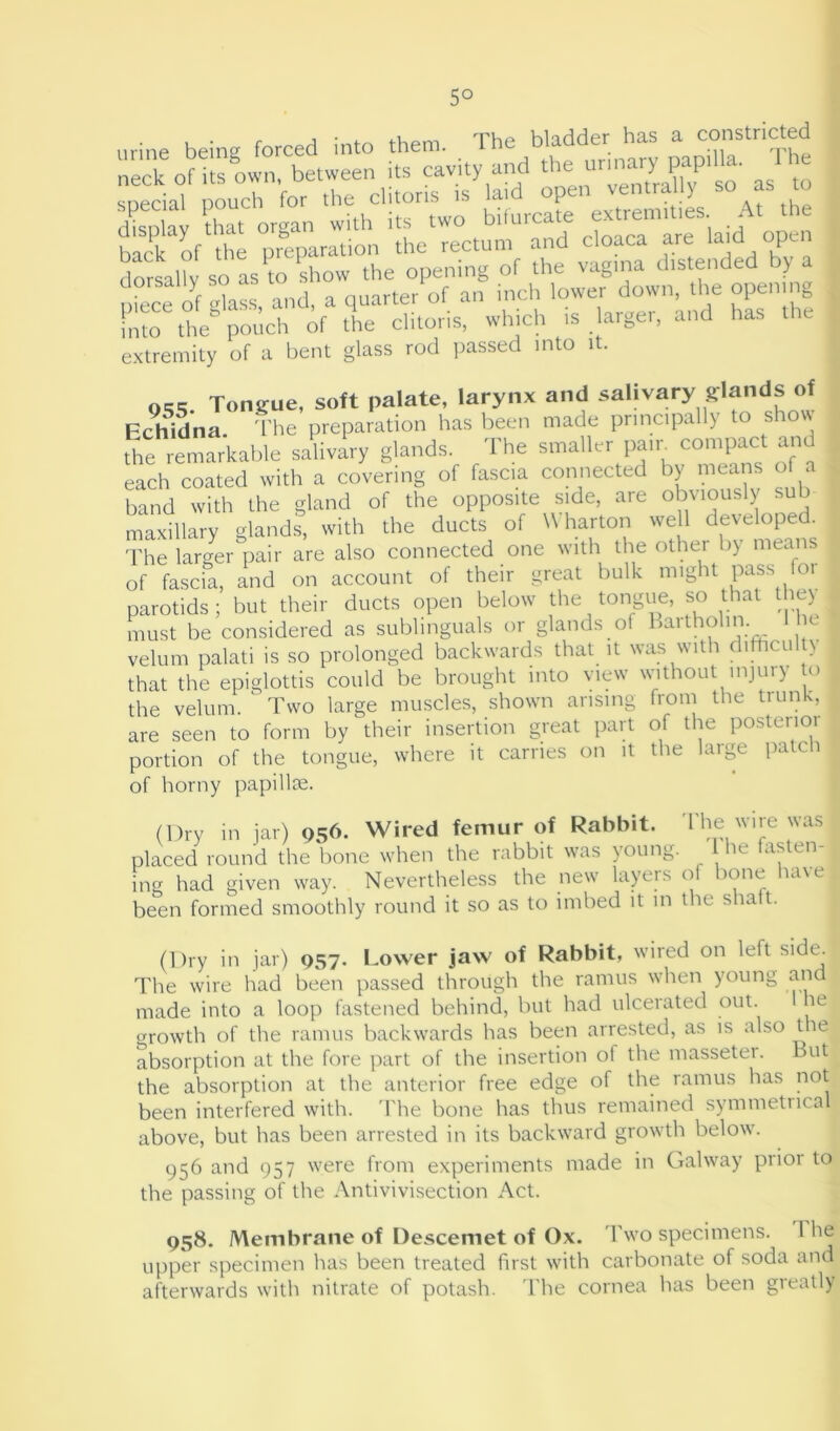 5° nrine being forced into them. The bladder has a constricted neckof own between its cavity and the unnary pap,11a. li e special pouch for the clitoris is laid open venial y so as o disnlav that organ with its two bifurcate extremities. At tne back of the preparation the rectum and cloaca are lard open dorsally so as to show the opening of the vagina distended y piece of glass, and. a quarter of an inch lower down the opening into the pouch of the clitoris, which is large., and has extremity of a bent glass rod passed into it. 0„ Tongue, soft palate, larynx and salivary glands of Echidna The preparation has been made principally to show the remarkable salivary glands. The smaller pair, compact and each coated with a covering of fascia connected by means of a band with the gland of the opposite side, are obviously sub maxillary glands, with the ducts of Wharton well developed. The larger pair are also connected one with the other by means of fascia, and on account of their great hulk might pass 1)1 parotids; but their ducts open below the tongue, so that lhe\ must be considered as sublinguals or glands of baithohn. li e velum palati is so prolonged backwards that it was with difficult) that the epiglottis could be brought into view without injury o the velum. ' Two large muscles, shown arising from the trunk, are seen to form by their insertion great part of the postenoi portion of the tongue, where it carries on it the large patch of horny papillte. (Dry in jar) 956. Wired femur of Rabbit. I he wire was placed round the bone when the rabbit was young. he fasten- ing had given way. Nevertheless the new layers of bone have been formed smoothly round it so as to imbed it in the shaft. (Dry in jar) 957. Lower jaw of Rabbit, wired on left side. The wire had been passed through the ramus when young an 1 made into a loop fastened behind, hut had ulcerated out. lie growth of the ramus backwards has been arrested, as is also the absorption at the fore part of the insertion of the masseter. the absorption at the anterior free edge of the ramus has not been interfered with. 'The hone has thus remained symmetrical above, but has been arrested in its backward growth below. 956 and 957 were from experiments made in Galway prior to the passing of the Antivivisection Act. 958. Membrane of Descemet of Ox. Two specimens. 1 lie upper specimen has been treated first with carbonate of soda and afterwards with nitrate of potash. The cornea has been greatly