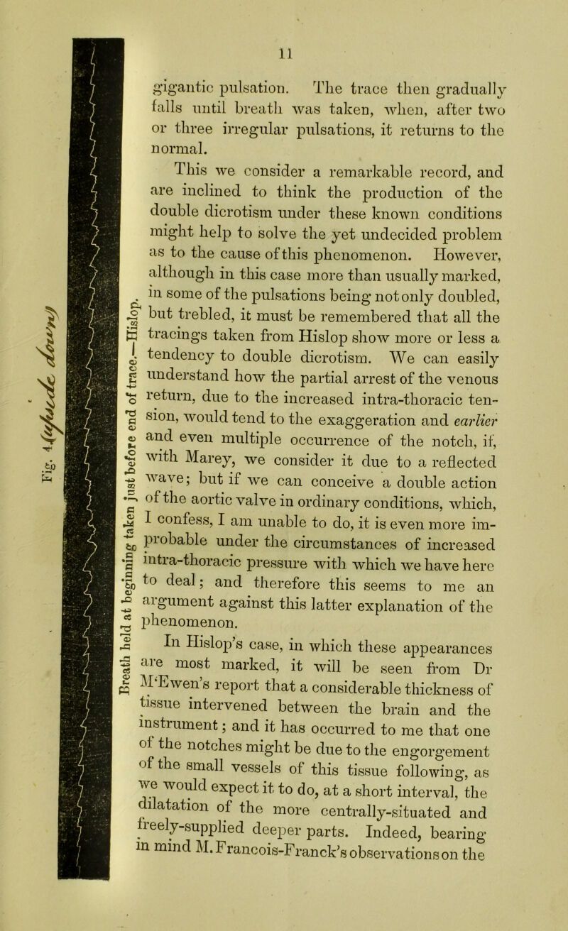 CO • »-l K gigantic pulsation. The trace then gradually falls until breath was taken, when, after two or three irregular pulsations, it returns to the normal. This we consider a remarkable record, and are inclined to think the production of the double dicrotism under these known conditions might help to solve the yet undecided problem as to the cause of this phenomenon. However, although in this case more than usually marked, in some of the pulsations being not only doubled, but trebled, it must be remembered that all the tracings taken from Hislop show more or less a i tendency to double dicrotism. We can easily S understand how the partial arrest of the venous *o return, due to the increased intra-thoracic ten- *§ si°n> would tend to the exaggeration and earlier cj and even multiple occurrence of the notch, if, js Marey, we consider it due to a reflected ro wave5 but if we can conceive a double action ^be aortic valve in ordinary conditions, which, *§ I confess, I am unable to do, it is even more im- t0 piobable under the circumstances of increased *3 biti a-thoracic pressure with which we have here *5b deal; and therefore this seems to me an 5 <ug’ument against this latter explanation of the * phenomenon. S In Hislop s case, in which these appearances | are most marked, it will be seen from Dr ! M‘Ewen’s report that a considerable thickness of tissue intervened between the brain and the instrument; and it has occurred to me that one of the notches might be due to the engorgement of the small vessels of this tissue following, as we would expect it to do, at a short interval, the dilatation of the more centrally-situated and freely-supplied deeper parts. Indeed, bearing in mind M. Francois-Franck’s observations on the