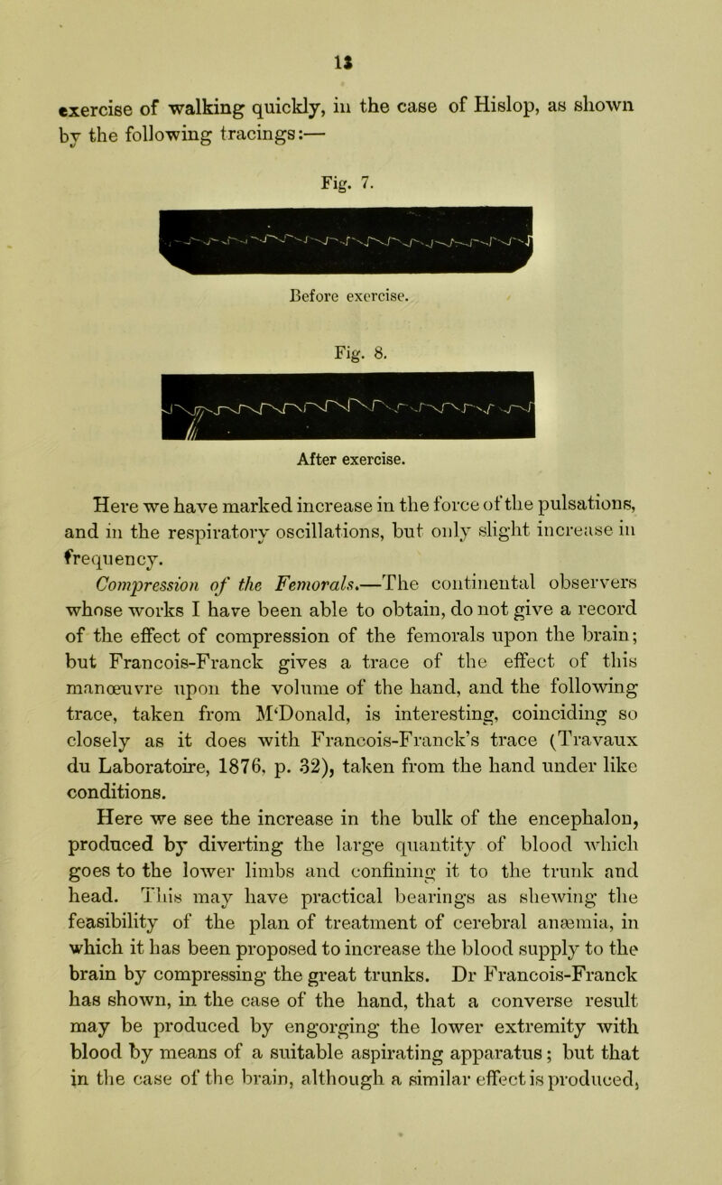 exercise of walking quickly, in the case of Hislop, as shown by the following tracings:— Fig. 8. After exercise. Here we have marked increase in the force of the pulsations, and in the respiratory oscillations, but only slight increase in frequency. Compression of the Femorals.—The continental observers whose works I have been able to obtain, do not give a record of the effect of compression of the femorals upon the brain; but Francois-Franck gives a trace of the effect of this manoeuvre upon the volume of the hand, and the following trace, taken from McDonald, is interesting, coinciding so closely as it does with Francois-Franck’s trace (Travaux du Laboratoire, 1876. p. 32), taken from the hand under like conditions. Here we see the increase in the bulk of the encephalon, produced by diverting the large quantity of blood which goes to the lower limbs and confining it to the trunk and head. This may have practical bearings as shewing the feasibility of the plan of treatment of cerebral anmmia, in which it has been proposed to increase the blood supply to the brain by compressing the great trunks. Dr Francois-Franck has shown, in the case of the hand, that a converse result may be produced by engorging the lower extremity with blood by means of a suitable aspirating apparatus; but that in the case of the brain, although a similar effect is produced.