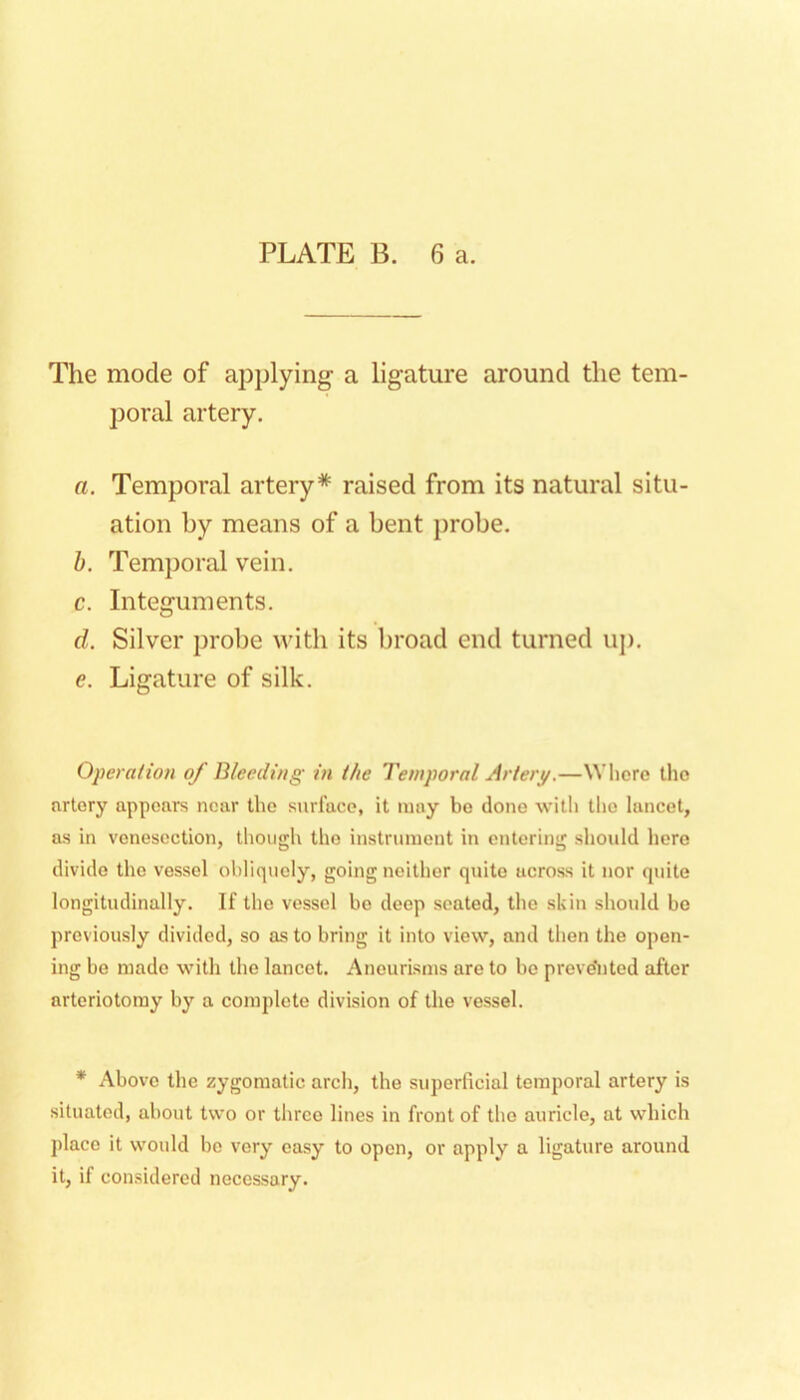 The mode of applying a ligature around the tem- poral artery, a. Temporal artery* raised from its natural situ- ation by means of a bent j)robe, h. Temporal vein. c. Integuments. d. Silver j)robe with its broad end turned up. e. Ligature of silk. Operation of Bleeding in the Temporal Artery.—Whore tho nrlory appears near tho surface, it may bo done with tlio lancet, as in venesection, though tho instrument in entering should here divide the vessel obliquely, going neither quite across it nor quite longitudinally. If tho vessel bo deep seated, the skin should be previously divided, so as to bring it into view, and then the open- ing bo made with the lancet. Aneurisms are to bo preve'nted after artoriotoray by a complete division of the vessel. * Above the zygomatic arch, the superficial temporal artery is situated, about two or three lines in front of tho auricle, at which place it would be very easy to open, or apply a ligature around it, if considered necessary.