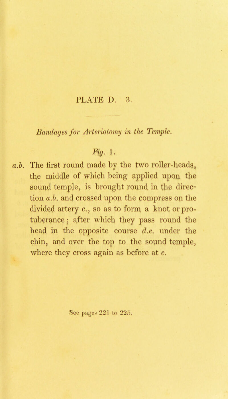 Bandages for Arteiiotomy in the Temple. Fig. 1. a.b. The first round made by the two roller-heads, the middle of which being applied upon the sound temple, is brought round in the direc- tion a.b. and crossed upon the compress on the divided artery c., so as to form a knot or pro- tuberance • after which they pass round the head in the opposite course d.e, under the chin, and over the top to the sound temple, where they cross again as before at c.