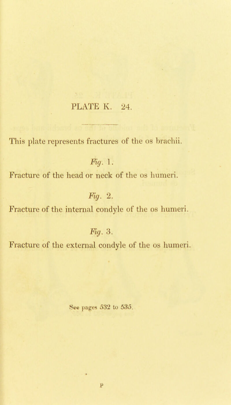 This plate represents fractures of the os hrachii. Fig. 1. Fracture of the head or neck of the os humeri. Fig. 2. Fracture of the internal condyle of the os humeri. Fig. 3. Fracture of the external condyle of the os humeri. pngos .532 to .5.3.5,