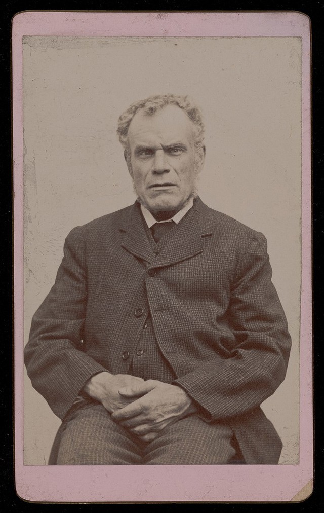 No text description is available for this image