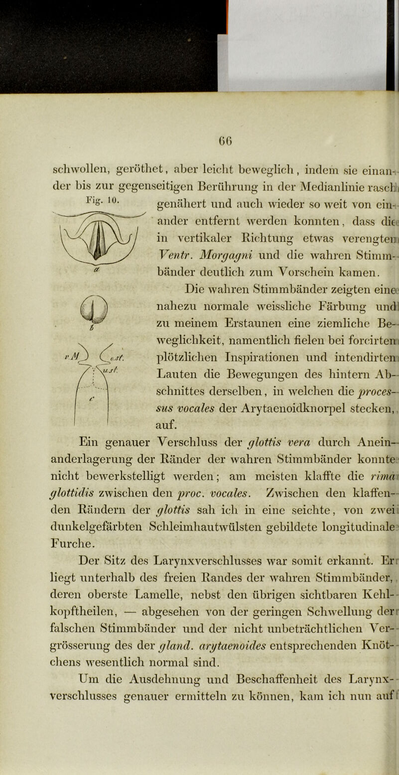 schwollen, geröthet, aber leicht beweglich, indem sie einan- der bis zur gegenseitigen Berührung in der Medianlinie rasch ( genähert und auch wieder so weit von ein- ander entfernt werden konnten, dass die in vertikaler Richtung etwas verengten Ventr. Morgagni und die wahren Stimm- bänder deutlich zum Vorschein kamen. Die wahren Stimmbänder zeigten eine nahezu normale weissliche Färbung und zu meinem Erstaunen eine ziemliche Be- weglichkeit, namentlich fielen bei forcirten t plötzlichen Inspirationen und intendirten sus vocales der Arytaenoidknorpel stecken, auf. Ein genauer Verschluss der glottis vera durch Anein- anderlagerung der Ränder der wahren Stimmbänder konnte nicht bewerkstelligt werden; am meisten klaffte die rima glottidis zwischen den proc. vocales. Zwischen den klaffen- den Rändern der glottis sah ich in eine seichte, von zwei dunkelgefärbten Schleimhautwülsten gebildete longitudinale Furche. Der Sitz des Larynxverschlusses war somit erkannt. Er liegt unterhalb des freien Randes der wahren Stimmbänder, deren oberste Lamelle, nebst den übrigen sichtbaren Kehl- kopftheilen, — abgesehen von der geringen Schwellung der falschen Stimmbänder und der nicht unbeträchtlichen Ver- grösserung des der gland. arytaenoides entsprechenden Knöt- chens wesentlich normal sind. Um die Ausdehnung und Beschaffenheit des Larynx- verschlusses genauer ermitteln zu können, kam ich nun auf plötzlichen Inspirationen und intendirten Lauten die Bewegungen des hintern Ab- schnittes derselben, in welchen die proces-