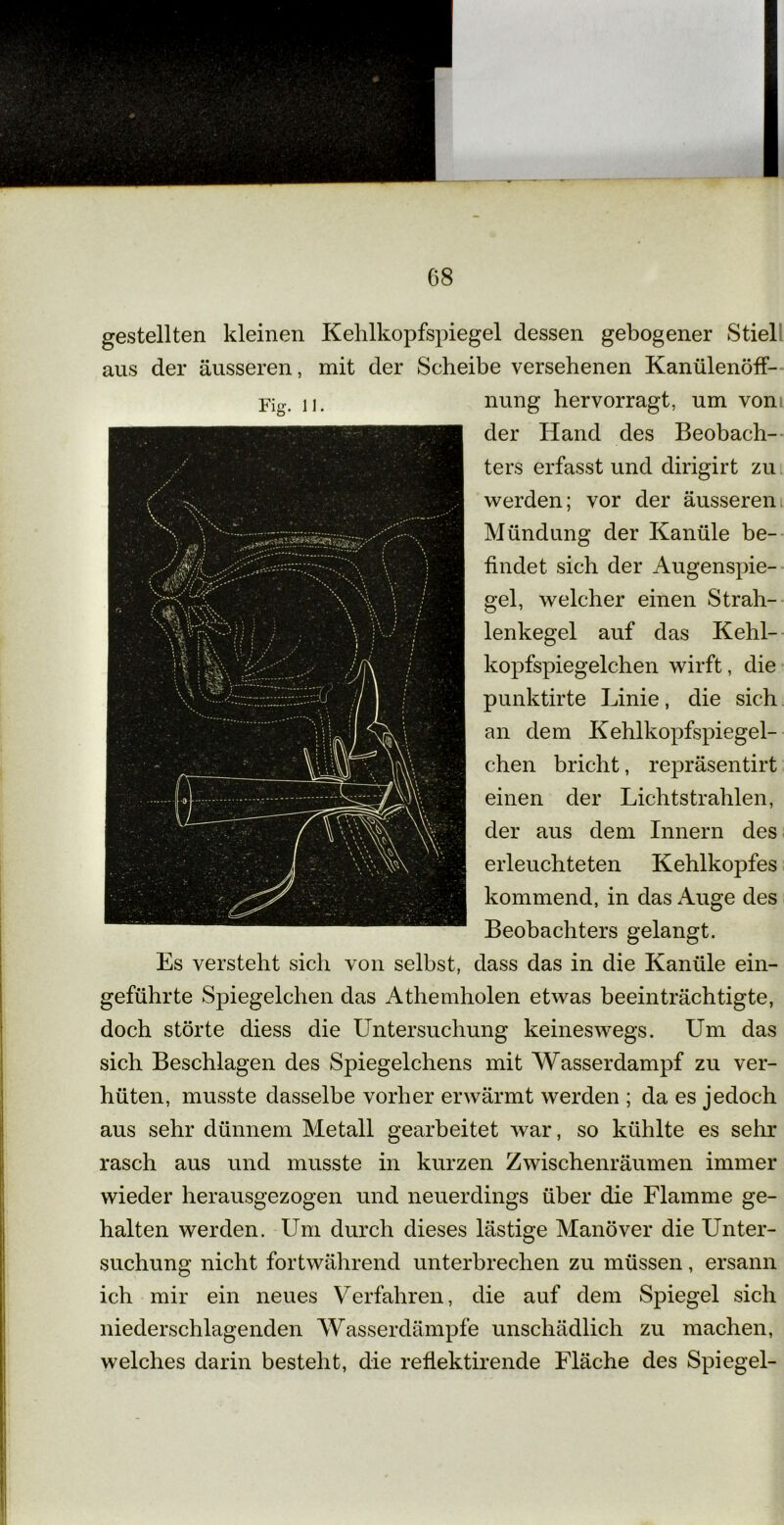 G8 gestellten kleinen Kehlkopfspiegel dessen gebogener Stiel aus der äusseren, mit der Scheibe versehenen Kanülenöff- nung hervorragt, um von ters erfasst und dirigirt zu werden; vor der äusseren Mündung der Kanüle be- findet sich der Augenspie- gel, welcher einen Strah- lenkegel auf das Kehl- kopfspiegelchen wirft, die punktirte Linie, die sich an dem Kehlkopfspiegel- chen bricht, repräsentirt einen der Lichtstrahlen, der aus dem Innern des erleuchteten Kehlkopfes kommend, in das Auge des Beobachters gelangt. Es versteht sich von selbst, dass das in die Kanüle ein- geführte Spiegelchen das Athemholen etwas beeinträchtigte, doch störte diess die Untersuchung keineswegs. Um das sich Beschlagen des Spiegelchens mit Wasserdampf zu ver- hüten, musste dasselbe vorher erwärmt werden ; da es jedoch aus sehr dünnem Metall gearbeitet war, so kühlte es sehr rasch aus und musste in kurzen Zwischenräumen immer wieder herausgezogen und neuerdings über die Flamme ge- halten werden. Um durch dieses lästige Manöver die Unter- suchung nicht fortwährend unterbrechen zu müssen, ersann ich mir ein neues Verfahren, die auf dem Spiegel sich niederschlagenden Wasserdämpfe unschädlich zu machen, welches darin besteht, die reflektirende Fläche des Spiegel-