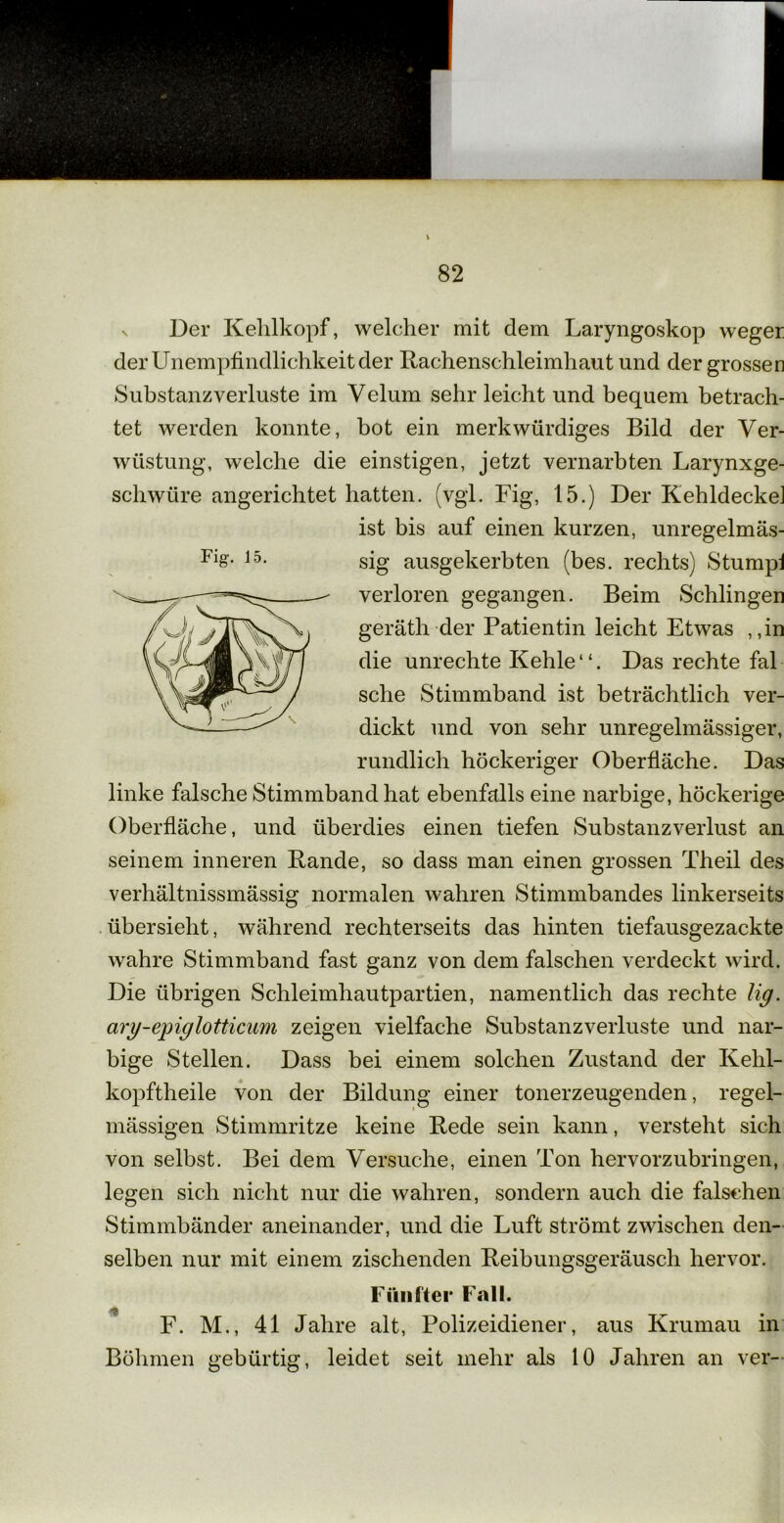 v Der Kehlkopf, welcher mit dem Laryngoskop weger der Unempfindlichkeit der Rachenschleimhaut und der grossen Substanzverluste im Velum sehr leicht und bequem betrach- tet werden konnte, bot ein merkwürdiges Bild der Ver- wüstung, welche die einstigen, jetzt vernarbten Larynxge- schwüre angerichtet hatten, (vgl. Fig, 15.) Der Kehldecke] ist bis auf einen kurzen, unregelmäs- sig ausgekerbten (bes. rechts) Stump! verloren gegangen. Beim Schlingen geräth der Patientin leicht Etwas ,,in die Unrechte Kehle“. Das rechte fal sehe Stimmband ist beträchtlich ver- dickt und von sehr unregelmässiger, rundlich höckeriger Oberfläche. Das linke falsche Stimmband hat ebenfalls eine narbige, höckerige Oberfläche, und überdies einen tiefen Substanzverlust an seinem inneren Rande, so dass man einen grossen Theil des verhältnissmässig normalen wahren Stimmbandes linkerseits übersieht, während rechterseits das hinten tiefausgezackte wahre Stimmband fast ganz von dem falschen verdeckt wird. Die übrigen Schleimhautpartien, namentlich das rechte Hg. ary-epiglotticum zeigen vielfache Substanzverluste und nar- bige Stellen. Dass bei einem solchen Zustand der Kelil- kopftheile von der Bildung einer tonerzeugenden, regel- mässigen Stimmritze keine Rede sein kann, versteht sich von selbst. Bei dem Versuche, einen Ton hervorzubringen, legen sich nicht nur die wahren, sondern auch die falschen Stimmbänder aneinander, und die Luft strömt zwischen den- selben nur mit einem zischenden Reibungsgeräusch hervor. Fünfter Fall. F. M., 41 Jahre alt, Polizeidiener, aus Krumau in Böhmen gebürtig, leidet seit mehr als 10 Jahren an ver-