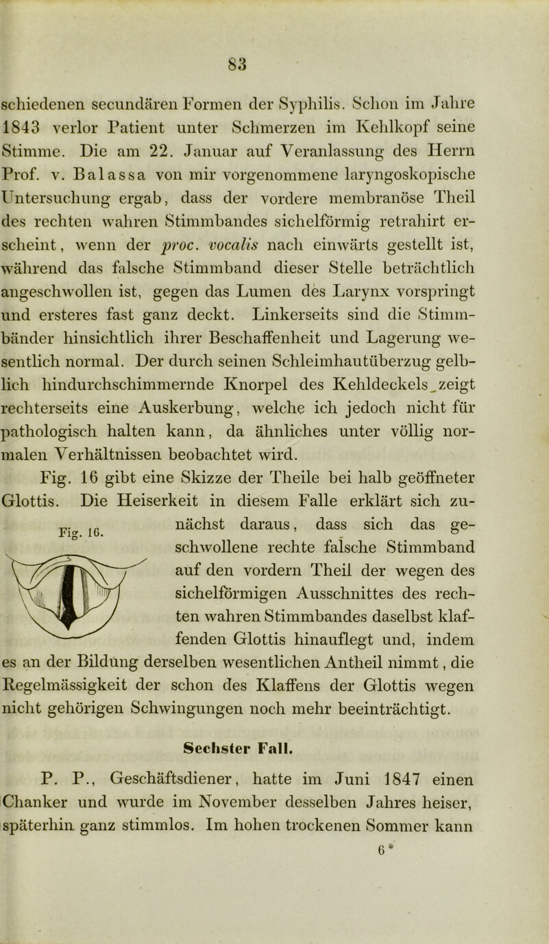 schiedenen secundären Formen der Syphilis. Schon im Jahre 1843 verlor Patient unter Schmerzen im Kehlkopf seine Stimme. Die am 22. Januar auf Veranlassung des Herrn Prof. v. Balassa von mir vorgenommene laryngoskopische Untersuchung ergab, dass der vordere membranöse Theil des rechten wahren Stimmbandes sichelförmig retrahirt er- scheint, wenn der proc. vocalis nach einwärts gestellt ist, während das falsche Stimmband dieser Stelle beträchtlich angeschwollen ist, gegen das Lumen des Larynx vorspringt und ersteres fast ganz deckt. Linkerseits sind die Stimm- bänder hinsichtlich ihrer Beschaffenheit und Lagerung we- sentlich normal. Der durch seinen Schleimhautüberzug gelb- lich hindurchschimmernde Knorpel des Kehldeckels _ zeigt rechterseits eine Auskerbung, welche ich jedoch nicht für pathologisch halten kann, da ähnliches unter völlig nor- malen Verhältnissen beobachtet wird. Fig. 16 gibt eine Skizze der Theile bei halb geöffneter Glottis. Die Heiserkeit in diesem Falle erklärt sich zu- nächst daraus, dass sich das ge- schwollene rechte falsche Stimmband auf den vordem Theil der wegen des sichelförmigen Ausschnittes des rech- ten wahren Stimmbandes daselbst klaf- fenden Glottis hinauflegt und, indem es an der Bildung derselben wesentlichen Antheil nimmt, die Kegelmässigkeit der schon des Klaffens der Glottis wegen nicht gehörigen Schwingungen noch mehr beeinträchtigt. . » P. P., Geschäftsdiener, hatte im Juni 1847 einen Chanker und wurde im November desselben Jahres heiser, späterhin ganz stimmlos. Im hohen trockenen Sommer kann 6*