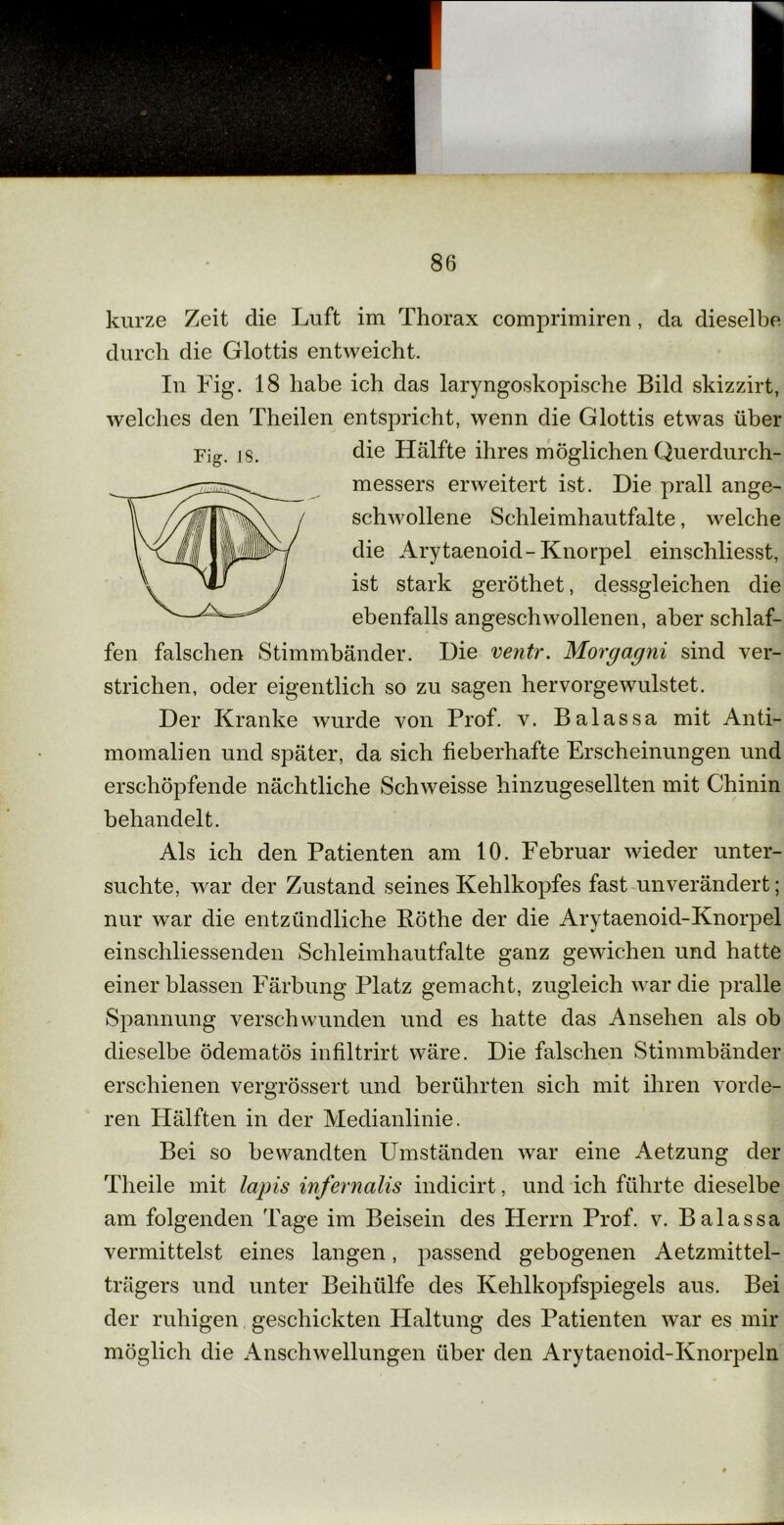 kurze Zeit die Luft im Thorax comprimiren, da dieselbe durch die Glottis entweicht. In Fig. 18 habe ich das laryngoskopische Bild skizzirt, welches den Theilen entspricht, wenn die Glottis etwas über Fig. iS. die Hälfte ihres möglichen Querdurch- messers erweitert ist. Die prall ange- schwollene Schleimhautfalte, welche die Arytaenoid-Knorpel einschliesst, ist stark geröthet, dessgleic-hen die ebenfalls angeschwollenen, aber schlaf- fen falschen Stimmbänder. Die ventr. Morgagni sind ver- strichen, oder eigentlich so zu sagen hervorgewulstet. Der Kranke wurde von Prof. v. Balassa mit Anti- momalien und später, da sich fieberhafte Erscheinungen und erschöpfende nächtliche Schweisse hinzugesellten mit Chinin behandelt. Als ich den Patienten am 10. Februar wieder unter- suchte, war der Zustand seines Kehlkopfes fast unverändert; nur war die entzündliche Pöthe der die Arytaenoid-Knorpel einschliessenden Schleimhautfalte ganz gewichen und hatte einerblassen Färbung Platz gemacht, zugleich war die pralle Spannung verschwunden und es hatte das Ansehen als ob dieselbe ödematös infiltrirt wäre. Die falschen Stimmbänder erschienen vergrössert und berührten sich mit ihren vorde- ren Hälften in der Medianlinie. Bei so bewandten Umständen war eine Aetzung der Theile mit lapis infernalis indicirt, und ich führte dieselbe am folgenden Tage im Beisein des Herrn Prof. v. Balassa vermittelst eines langen, passend gebogenen Aetzmittel- trägers und unter Beihülfe des Kehlkopfspiegels aus. Bei der ruhigen geschickten Haltung des Patienten war es mir möglich die Anschwellungen über den Arytaenoid-Knorpeln