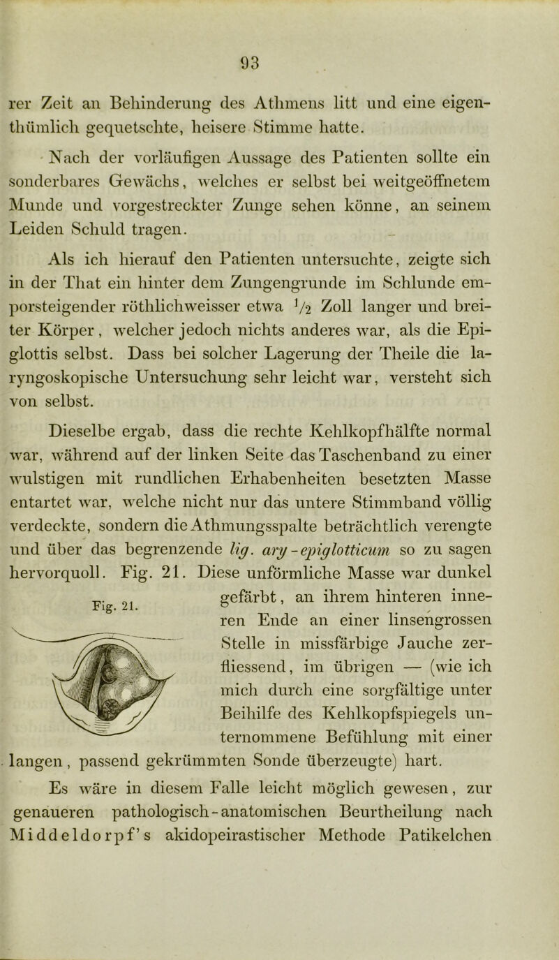 rer Zeit an Behinderung des Athmens litt und eine eigen- tümlich gequetschte, heisere Stimme hatte. Nach der vorläufigen Aussage des Patienten sollte ein sonderbares Gewächs, welches er selbst bei weitgeöfFnetem Munde und vorgestreckter Zunge sehen könne, an seinem Leiden Schuld tragen. Als ich hierauf den Patienten untersuchte, zeigte sich in der That ein hinter dem Zungengrunde im Schlunde em- porsteigender röthlichweisser etwa V2 Zoll langer und brei- ter Körper, welcher jedoch nichts anderes war, als die Epi- glottis selbst. Dass bei solcher Lagerung der Theile die la- ryngoskopische Untersuchung sehr leicht war, versteht sich von selbst. Dieselbe ergab, dass die rechte Kehlkopf hälfte normal war, während auf der linken Seite das Taschenband zu einer wulstigen mit rundlichen Erhabenheiten besetzten Masse entartet war, welche nicht nur das untere Stimmband völlig verdeckte, sondern die Athmungsspalte beträchtlich verengte und über das begrenzende lig. arg - epiglotticum so zu sagen hervorquoll. Fig. 21. Diese unförmliche Masse war dunkel gefärbt, an ihrem hinteren inne- Fig. 21. ren Ende an einer linsengrossen Stelle in missfärbige Jauche zer- fiiessend, im übrigen — (wie ich mich durch eine sorgfältige unter Beihilfe des Kehlkopfspiegels un- ternommene Befühlung mit einer langen, passend gekrümmten Sonde überzeugte) hart. Es wäre in diesem Falle leicht möglich gewesen, zur genaueren pathologisch - anatomischen Beurtheilung nach Middeldorpf’s akidopeirastischer Methode Patikelchen