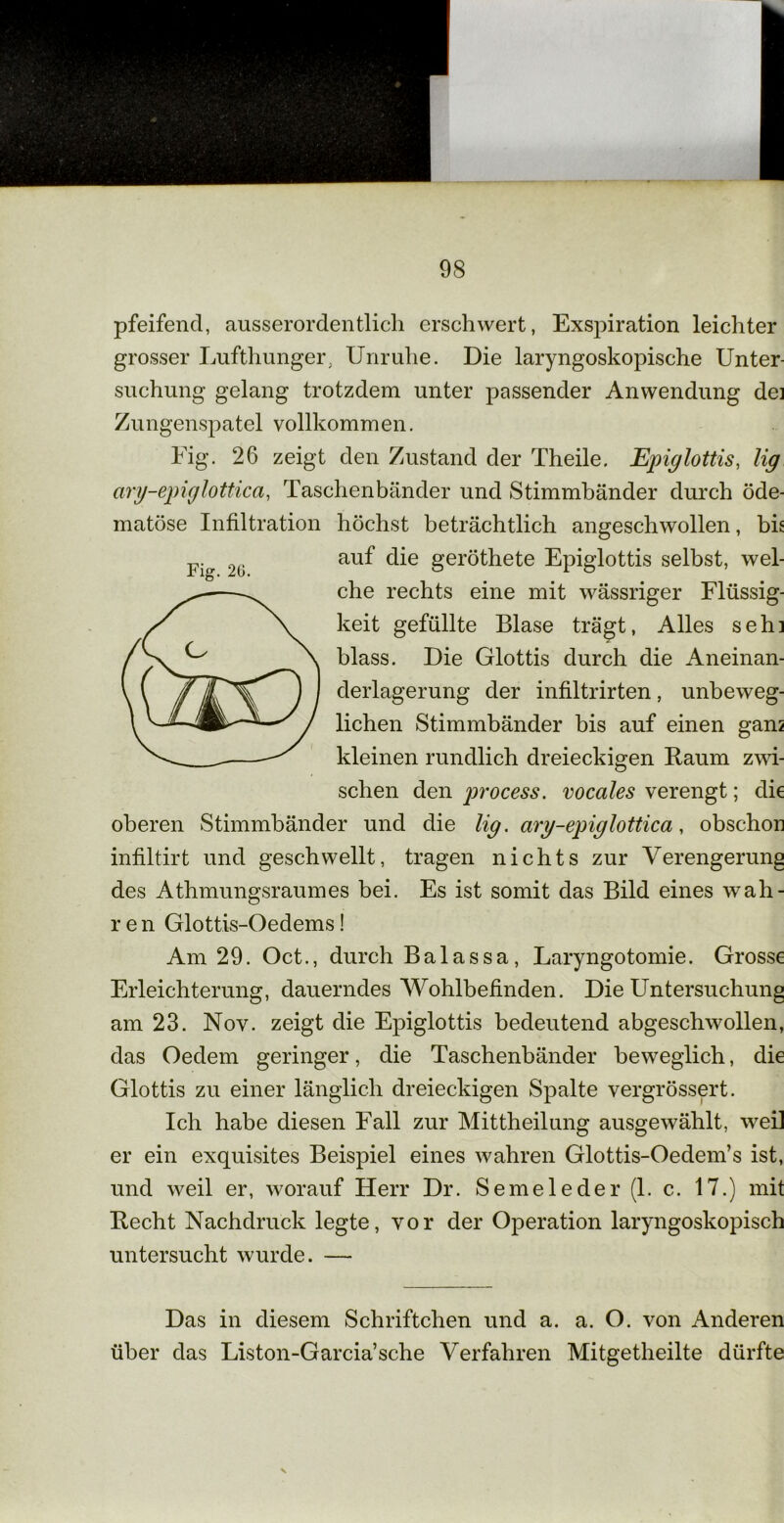pfeifend, ausserordentlich erschwert, Exspiration leichter grosser Lufthunger, Unruhe. Die laryngoskopische Unter- suchung gelang trotzdem unter passender Anwendung de] Zungenspatel vollkommen. Fig. 26 zeigt den Zustand der Theile. Epiglottis, lig ary-epiglottica, Taschenbänder und Stimmbänder durch öde- matöse Infiltration höchst beträchtlich angeschwollen, bk auf die geröthete Epiglottis selbst, wel- che rechts eine mit wässriger Flüssig- keit gefüllte Blase trägt, Alles seh] blass. Die Glottis durch die Aneinan- derlagerung der infiltrirten, unbeweg- Fig. 2G. liehen Stimmbänder bis auf einen gam kleinen rundlich dreieckigen Baum zwi- schen den process. vocales verengt; die oberen Stimmbänder und die lig. ary-epiglottica, obschor infiltirt und geschwellt, tragen nichts zur Verengerung des Athmungsraumes bei. Es ist somit das Bild eines wah- ren Glottis-Oedems! Am 29. Oct., durch Balassa, Laryngotomie. Grosse Erleichterung, dauerndes Wohlbefinden. Die Untersuchung am 23. Nov. zeigt die Epiglottis bedeutend abgeschwollen, das Oedem geringer, die Taschenbänder beweglich, die Glottis zu einer länglich dreieckigen Spalte vergrössert. Ich habe diesen Fall zur Mittheilung ausgewählt, weil er ein exquisites Beispiel eines wahren Glottis-Oedem’s ist, und weil er, worauf Herr Dr. Seineleder (1. c. 17.) mit Becht Nachdruck legte, vor der Operation laryngoskopisch untersucht wurde. — Das in diesem Schriftchen und a. a. O. von Anderen über das Liston-Garcia’sche Verfahren Mitgetheilte dürfte