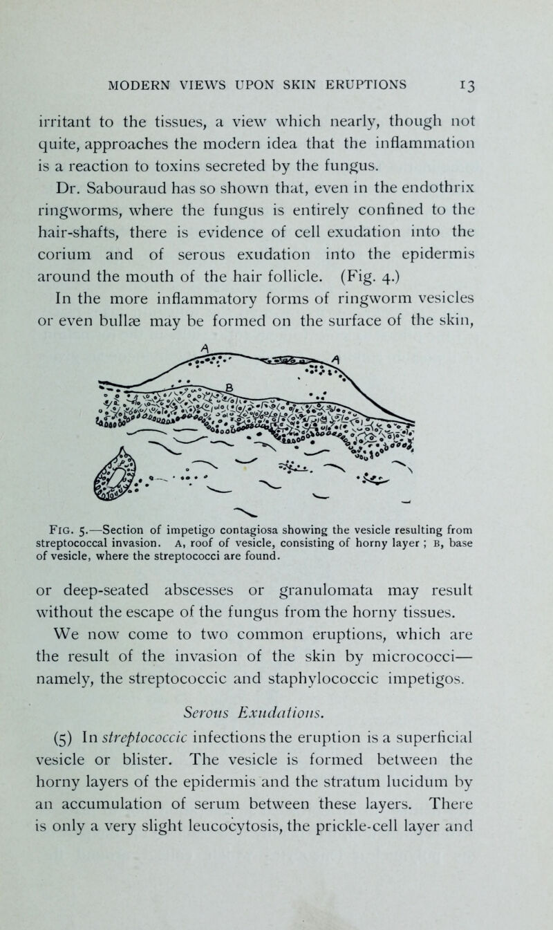 irritant to the tissues, a view which nearly, though not quite, approaches the modern idea that the inflammation is a reaction to toxins secreted by the fungus. Dr. Sabouraud has so shown that, even in the endothrix ringworms, where the fungus is entirely confined to the hair-shafts, there is evidence of cell exudation into the corium and of serous exudation into the epidermis around the mouth of the hair follicle. (Fig. 4.) In the more inflammatory forms of ringworm vesicles or even bullae may be formed on the surface of the skin. Fig. 5.—Section of impetigo contagiosa showing the vesicle resulting from streptococcal invasion, a, roof of vesicle, consisting of horny layer ; b, base of vesicle, where the streptococci are found. or deep-seated abscesses or granulomata may result without the escape of the fungus from the horny tissues. We now come to two common eruptions, which are the result of the invasion of the skin by micrococci— namely, the streptococcic and staphylococcic impetigos. (5) \n streptococcic infections the eruption is a superlicial vesicle or blister. The vesicle is formed between the horny layers of the epidermis and the stratum lucidum by an accumulation of serum between these layers. Thei e is only a very slight leucocytosis, the prickle-cell layer and Serous Exudations.