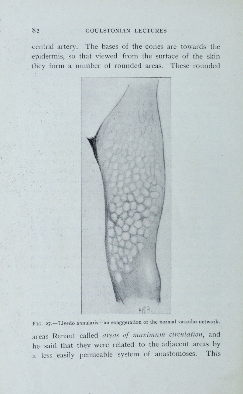 central artery. The bases of the cones are towards the epidermis, so that viewed from the surface of the skin they form a number of rounded areas. These rounded PiQ, 27.—Livedo annularis—an exaggeration of the normal vascular network. areas Kenaut called areas of maximum circulation, and he said that they were related to the adjacent areas by a less easily permeable system of anastomoses. This