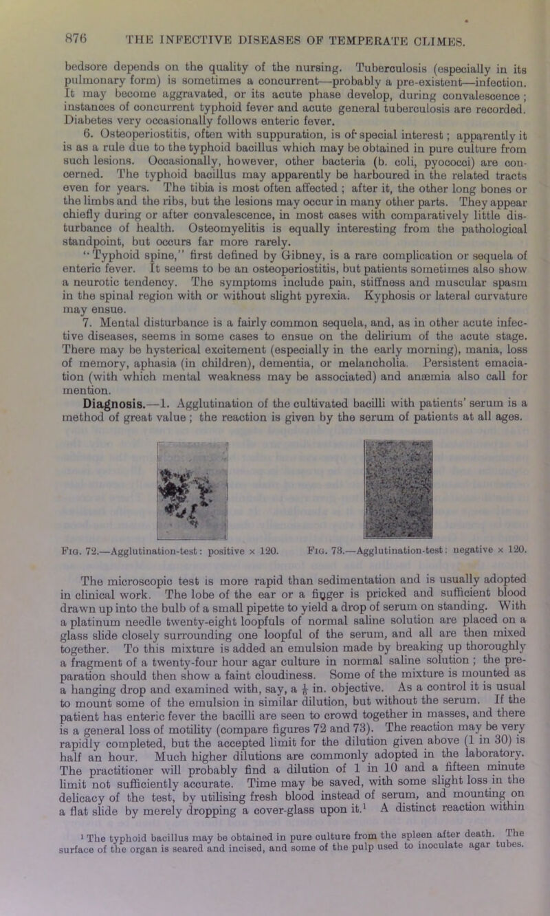 bedsore depends on the quality of the nursing. Tuberculosis (especially in its pulmonary form) is sometimes a concurrent—probably a pre-existent—infection. It may become aggravated, or its acute phase develop, during convalescence ; instances of concurrent typhoid fever and acute general tuberculosis are recorded. Diabetes very occasionally follows enteric fever. 6. Osteoperiostitis, often with suppuration, is oh special interest; apparently it is as a rule due to the typhoid bacillus which may be obtained in pure culture from such lesions. Occasionally, however, other bacteria (b. coli, pyococci) are con- cerned. The typhoid bacillus may apparently be harboured in the related tracts even for years. The tibia is most often affected ; after it, the other long bones or the limbs and the ribs, but the lesions may occur in many other parts. They appear chiefly during or after convalescence, in most cases with comparatively little dis- turbance of health. Osteomyelitis is equally interesting from the pathological standpoint, but occurs far more rarely. ‘‘Typhoid spine,” first defined by Gibney, is a rare complication or sequela of enteric fever. It seems to be an osteoperiostitis, but patients sometimes also show a neurotic tendency. The symptoms include pain, stiffness and muscular spasm in the spinal region with or without slight pyrexia. Kyphosis or lateral curvature may ensue. 7. Mental disturbance is a fairly common sequela, and, as in other acute infec- tive diseases, seems in some cases to ensue on the delirium of the acute stage. There may be hysterical excitement (especially in the early morning), mania, loss of memory, aphasia (in children), dementia, or melancholia. Persistent emacia- tion (with which mental weakness may be associated) and anaemia also call for mention. Diagnosis.—1. Agglutination of the cultivated bacilli with patients’ serum is a method of great value; the reaction is given by the serum of patients at all ages. ••• j ■ ••• <t j] ■ r ■ -XJ Fio. 72.—Agglutination-test: positive x 120. Fie. 78.—Agglutination-test: negative x 120. The microscopic test is more rapid than sedimentation and is usually adopted in clinical work. The lobe of the ear or a finger is pricked and sufficient blood drawn up into the bulb of a small pipette to yield a drop of serum on standing. With a platinum needle twenty-eight loopfuls of normal saline solution are placed on a glass slide closely surrounding one loopful of the serum, and all are then mixed together. To this mixture is added an emulsion made by breaking up thoroughly a fragment of a twenty-four hour agar culture in normal saline solution ; the pre- paration should then show a faint cloudiness. Some of the mixture is mounted as a hanging drop and examined with, say, a ^ in. objective. As a control it is usual to mount some of the emulsion in similar dilution, but without the serum. If the patient has enteric fever the bacilli are seen to crowd together in masses, and there is a general loss of motility (compare figures 72 and 73). The reaction may be very rapidly completed, but the accepted limit for the dilution given above (1 in 30) is half an hour. Much higher dilutions are commonly adopted in the laboratory. The practitioner will probably find a dilution of 1 in 10 and a fifteen minute limit not sufficiently accurate. Time may be saved, with some slight loss in the delicacy of the test, by utilising fresh blood instead of serum, and mounting on a flat slide by merely dropping a cover-glass upon it.1 A distinct reaction within 1 The typhoid bacillus may be obtained in pure culture from the spleen after death. I he surface of the organ is seared and incised, and some of the pulp used to inoculate agar u )es.