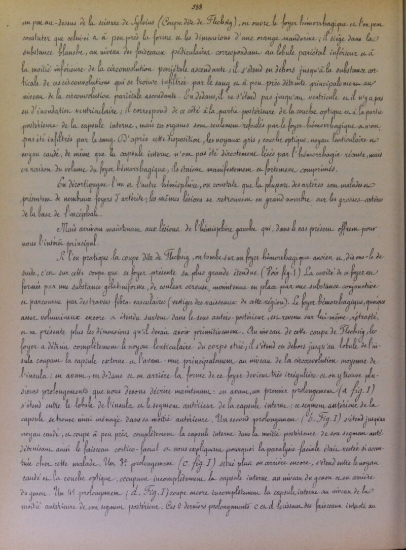 J'55 Pt tu- écUi\ut dt Si^tviuà Pt-} , «t ÿMlct- tiMutrinlxi^lc^ui.- t^cf'i »m i-W flw. mul'eUtï ^ut. itïlii'ti A. rt. jjeu. j^/’j ii^ jt m MM. ful*jl CKKKU itïiU'ti A. 'lui , au lut-eou (TittUc. «. ^ ^iiAUidJi'cUi y UAix MoM^axMi. ; tf<fiW P«i« P#4 joi^ceaux. j3(diciJ(WU/i au ioiuÈt. j>cviichti t’u^ekiewi ti.A. li. ^M^tù■ ù^iiûwu' ix C4kcoM>ûùjûfK- jia'ùtbxL oJcgtDcudc j ît J'èhu^ im. ^Héc^u'dtcL àuiijh ^Ccoîi dt cii u’icouv(^iA^ÿjuÀ ijtu êt itoUA'e iujtlAuc jjat te. Jaun èî ?èJ^i4*te Ÿ^tHcijOaÈ! hi^i rauLCt coï' I ' / / ' I I ' vùveau. hL eàcouvJidiûu j>a/iltl,Jg. x-ieeiûoM^t . ^u. nt.â'{Jau^ ju)cju'm<. ven^daji tui'fu'yo.^ eu Vtti/fWcuiout/, ; l't C^utinavul 9c ce cède X ix .oaniu- ^hklewu 9cL couciiC- apfkttu. ce^cL fxfiaitu. ,L!. .P .1. ' . . .V [ù.t DJ h [r . ' auu-- tl^^ .^ei\v^\tuKt-^ 9& tx- exj^uie iwlMKt,, wuiu ct^ mcjoutô J(»u^ 6cuÙM£M4.--refeuÉcj ijox-it ^ 4pxi ih tîoa i/. iaua. 02'ceiti}u^MlÀ.avt .^moucuuc alie r ewetc(rf/tu*ue ,*tcucui tiu^icu^aù 1 J . ô' ' rç ^J . , uo^au cau^t, tfe »H/4Ut «jut fa. ûaj^*Mt nUemt u'ûm- jjoe êie^ Jt^tyrtm^nU ceeee ^yax f’fjg'tMvrhaju- >c/chUi ,i4uu/ veiuwe- du- jl^ec^ttttuyi^ia^Cijue-, lû thueui. v*uuu - exjmhuieuc. c'mujfiùuéj C'A. 'rtiiJtm i?u. ^/coltK^uauu i* W ei. ^'aulxe t CMuJ^fH'U-f ou unAehi/c cjut, t>- ^u^euii- 9ee a - 9c rtOV«luti« ■K\jCU 9 Xt^vùkt • tei MAtWH iui'cnu Àt /U^\C<\MlUA' tu KrW^ i)t fo. lioJt 3t f'wcejrimL. •MaM CffUC i*UiÊx9tJ ti,.P i^tc iut il* ^^iuA--cvdiue clU OAuvcm auiutitHow. awc Icâùnui 9e i'iértUÀjt^ixc ejui, 9 au* È ta* Ÿ^ifAu- ^KMx jjiaur UOUi /fntMf^af Si. i'ou jno^ujiw -tx ccujJt 9ik 9t ,eH ffuile Ju/c un ^îmouÉa^i jvœ /tucceu 9e. ^Mpt, t'c*i~ -iux ce-hlt Coupe- qutf <u foutt -AtUieuh Jo. inue ficmdt étcu9ue ( Ÿifw Kâ.j ) Jux cauibt 9e et jouet tiU f eJ^ln .P. l J  9 ., '» 9 ^ 7 .,. oTuut nojt mj e*~ boflcviotuc ^uILtauci-^èLh\ùjoztUc ,9i eoS{ 'eux 0Cxeu*c_ vuxduklAAUt. tu jtixee. ^cut-utte ^uSitàuee- (•-tn^oKthÀfC' j^ax ?t.i (ravéo jitte- vaicAiIacie* ^•etMicjc* 9c* voù^eaux- 9* ctUe ^t^Ccu). S ^tl tcMuttÈa^uefCjucu^ a**ti. vciuMxè^uAAÂ: mectc ehudu Juxhuc- ?a*u it-ieu* atdttû-jfoituieux. ,cn.Ke*>euu Aux '^-mmuc-,Kf^taph, tu tu. h j^tciiukt l*iu* it) di'iuaujùnu (ju'ii ^evacA. CLvour yruuûPù/uueui--. (^utùoeau. Je ee^9e cau^e9e.^Reottij ,■&/’ IX. A detxuM- eciUji^ te lue nuy it. uo^ au teiihi cufjiwu 9u ccxj** ihuc-ti i'ehu9 eu èeftâxi jueiju'au ioiuic 9efiù- iutx couj^auL- L. fAjfJuL txitnuc eu f'ai^a*u- -wut -jriiHeci^aftHuytiL au Mueau. 9e iacvccffAunuKcnt iHtxjimAi de -f't'uâufa. ; UA 0A)aui.., tu eu eu. evixicic-ia. jirnut 9e. ce. ituçjuiièxe. clok^Uouvc yA- ^iCM* ^tefetu^eMau^à ^ut-uou* ')cio^u diouxi lucuù^eueucL•■ c*< 0A'>a4U-,i*M jneHuit ^XtSoit^cMeuuy^'t j-i^.l) /'«-(«♦ù) cutîf te. iotuit- 9t'i' in* ula tu ft-éi^ncelii. enih-iitAUi,- dt ta. ca^iuL. inhiuc.. ; ecAe^jiueuc xutixAeux 9c ix. cxjfjuù. ^fwuvt OAUti cuiuAcjty dau* Ax moit^c eiuh'xUuu. Slu iteotO ^xaiou^ettcML. ( .iic^tud^utt^au ttv^nu taùic ,et~ccu^t tC jicu jtTM. celHJ^utt^ueM~ ia. caj^juÈ iuhiut. 9aui ia. uteitic ^ffikxitwtc }e. AtrU-Aejmau.-tw^c'. U uoH* cAy^ùjiMXiu.- i^oweouxi ^ujTcua^it -jAeuiic eh^^^ UC /c. j .Jihù jruui eu oovutxt- tue-oXL-, J'efecû) dt'huùauu auuc ie faÎActcut cavtico - jaecut hJt eîux, eeMi i*u JL},. .îk ^ l^xSu^euceuc eau9e ei_ da- ccuefec cccuÇpuu^- iuccou^fcf'eutmu. ix- leajeAulc l'icfiuu. au tuuxuc du^ îu ijfctwnt.. ^(i* jtrSiujumuL. ^ d,.Ijeou^t tucetc. iv-eoUc^lÏMVMC. îa caj^Juiuiuhiuc- ■tuovtu ciiJxkiuiKcdciou ic^uuuc. jAojIlÀèeut.. (PeJ ê )exuu'tA jyToirrfi^MueuÙ C euJ. iciiÀAxtU^icA jeuAVOM. iu^eix au. huu^ xu^ee ùi acem ■ te*J uUu (e.uo<iUtc (> eueu eceu awueXC' au uweau- 9e iu^ ’’