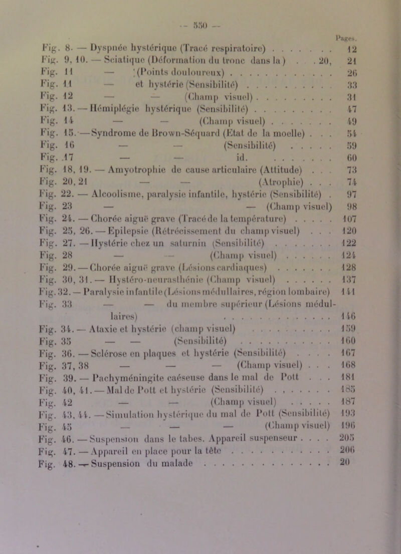 530 Page». Fig. 8. — Dyspnée hystérique (Tracé respiratoire) 12 Fig. 9,10. — Sciatique (Déformation du tronc dans la) . .20, 21 Fig. I l — ' (Points douloureux) 20 Fig. 11 — et hystérie (Sensibilité) 33 Fig. 12 — — (Champ visuel) 31 Fig. 13. — Hémiplégie hystérique (Sensibilité) 47 Fig. 14 — — (Champ visuel) 49 Fig. 13.—Syndrome de Brown-Séquard (Etat de la moelle) . . . 54 Fig. 10 — — (Sensibilité) 59 Fig. .17 — — id. 00 Fig. 18,19. — Amyotrophie de cause articulaire (Attitude) ... 73 Fig. 20,21 — — (Atrophie) . . . 74 Fig. 22. — Alcoolisme, paralysie infantile, hystérie (Sensibilité) . 97 Fig. 23 — — (Champ visuel) 98 Fig. 24. — Chorée aiguë grave (Tracé de la température) 107 Fig. 25,20. — Epilepsie (Rétrécissement du champvisuel) . . . 120 Fig. 27.—Hystérie chez un saturnin (Sensibilité) 122 Fig. 28 — (Champ visuel) 124 Fig. 29. — Chorée aiguë grave (Lésionscardiaques) 128 Fig. 30,31.— Hystéro-neurasthénie (Champ visuel) 137 Fig. 32. — Paralysie infantile (Lésions médullaires, région lombaire) 1 41 Fig. 33 — — du membre supérieur (Lésions médul- laires) 146 Fig. 34. — Ataxie et hystérie (champvisuel) 159 Fig. 35 — — (Sensibilité) 100 Fig. 30.—Sclérose en plaques et hystérie (Sensibilité) .... 107 Fig. 37, 38 — — — (Champ visuel) ... 108 Fig. 39. — Pachyméningite caéseuse dans le mal de Pott . . . 181 Fig. 40,41. — Mal de Pott et hystérie (Sensibilité) . 185 Fig. 42 — — (Champ visuel) 187 Fig. 43,44.—Simulation hystérique du mal de Pott (Sensibilité) 193 Fig. 45 — — — (Champvisuel) 190 Fig. 40.—Suspension dans le tabes. Appareil suspenseur . . . . 205 Fig. 47. —Appareil en place pour la tète 200 Fig. 48. Suspension du malade 20