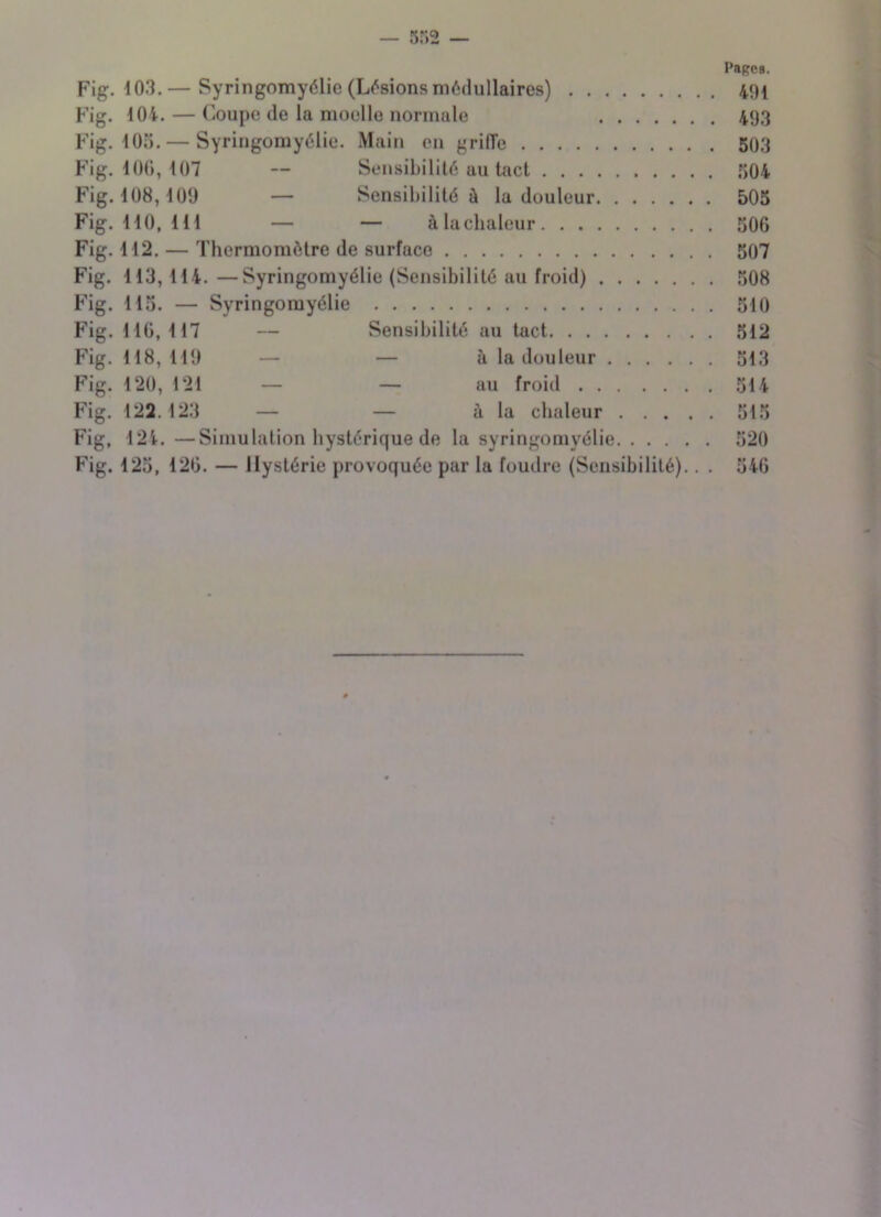 Papes. Fig. 103.— Syringomyélie (Lisions médullaires) 491 Fig. 104. — Coupe de la moelle normale 493 Fig. 105. — Syringomyélie. Main en griffe 503 Fig. 100, 107 — Sensibilité au tact 504 Fig. 108,109 — Sensibilité à la douleur 505 Fig. 110, 111 — — à la chaleur 506 Fig. 112. — Thermomètre de surface 507 Fig. 113,114. —Syringomyélie (Sensibilité au froid) 508 Fig. 115. — Syringomyélie 510 Fig. 116,117 — Sensibilité au tact 512 Fig. 118, 119 — — à la douleur 513 Fig. 120, 121 — — au froid 514 Fig. 122.123 — — à la chaleur 515 Fig, \2ï. —Simulation hystérique de la syringomyélie 520 Fig. 125, 126. — Hystérie provoquée par la foudre (Sensibilité).. . 546