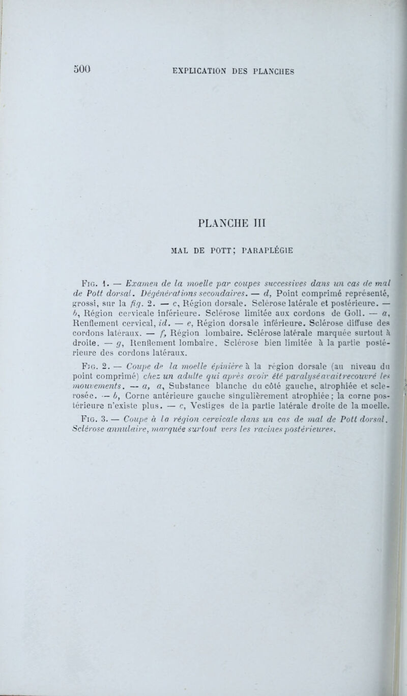 500 PLANCHE III MAL DE POTT; PARAPLÉGIE Fig. \. — Examen de la moelle par coupes successives dans un cas de mal de Pott dorsal. Dégénérations secondaires. — d, Point comprimé représenté, grossi, sur la fig. 2. — c, Région dorsale. Sclérose latérale et postérieure. — 6, Région cervicale inférieure. Sclérose limitée aux cordons de Goll. — a, Renflement cervical, id. — e, Région dorsale inférieure. Sclérose diffuse des cordons latéraux. — ft Région lombaire. Sclérose latérale marquée surtout droite. — g, Renflement lombaire. Sclérose bien limitée à la partie posté- rieure des cordons latéraux. Fig. 2. — Coupe de la moelle épinière à la région dorsale (au niveau du point comprimé) chez un adulte qui après avoir été paralysé avait recouvré les mouvements. —a, a, Substance blanche du côté gauche, atrophiée et scie- rosée. — b, Corne antérieure gauche singulièrement atrophiée; la corne pos- térieure n’existe plus. — c, Vestiges delà partie latérale droite de la moelle. Fig. 3. — Coupe à la région cervicale da?is un cas de mal de Pott dorsal. Sclérose annulaire, marquée surtout vers les racines postérieures.