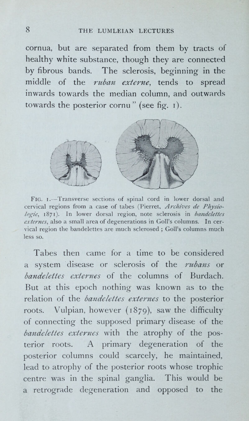 cornua, but are separated from them by tracts of healthy white substance, though they are connected by fibrous bands. The sclerosis, beginning in the middle of the ruban ext erne, tends to spread inwards towards the median column, and outwards towards the posterior cornu ” (see fig. i). Fig. i.—Transverse sections of spinal cord in lower dorsal and cervical regions from a case of tabes (Pierret, Archives de Physio- logie, 1871). In lower dorsal region, note sclerosis in bandelettes externes, also a small area of degenerations in Goll’s columns. In cer- vical region the bandelettes are much sclerosed ; Goll’s columns much less so. Tabes then came for a time to be considered a system disease or sclerosis of the mibans or bandelettes externes of the columns of Burdach. But at this epoch nothing was known as to the relation of the bandelettes externes to the posterior roots. Vulpian, however (1879), saw the difficulty of connecting the supposed primary disease of the bandelettes externes with the atrophy of the pos- terior roots. A primary degeneration of the posterior columns could scarcely, he maintained, lead to atrophy of the posterior roots whose trophic centre was in the spinal ganglia. This would be a retrograde degeneration and opposed to the