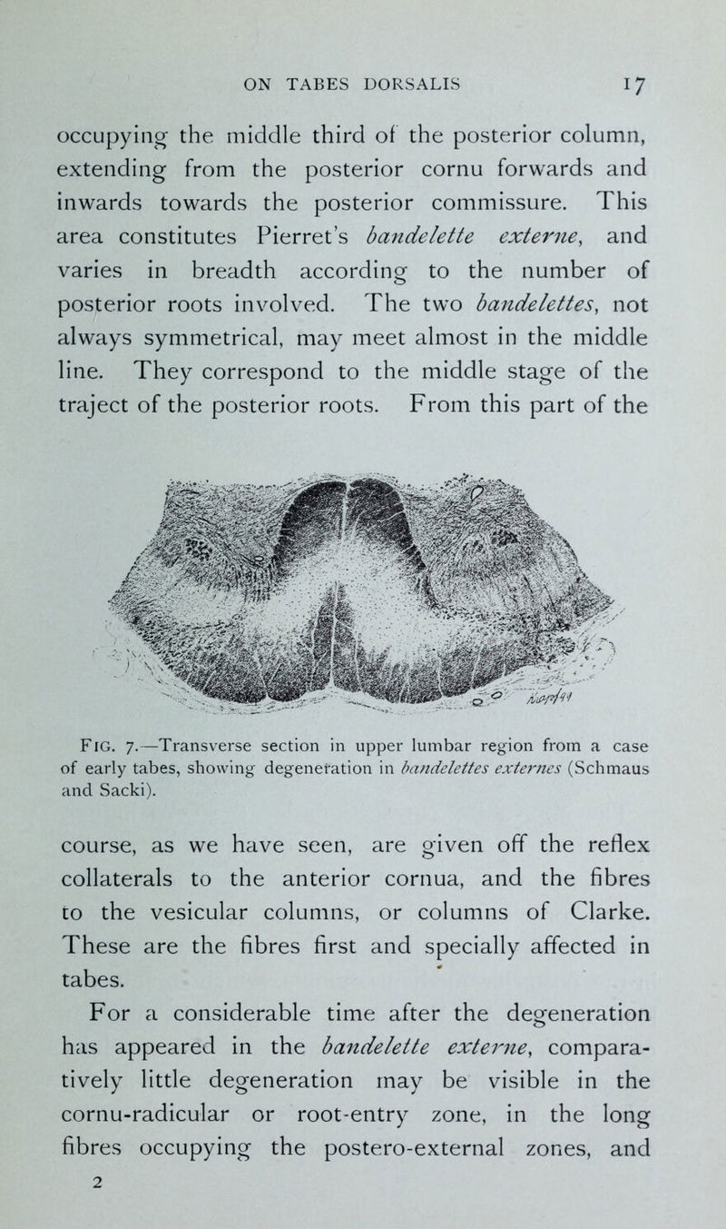 occupying the middle third of the posterior column, extending from the posterior cornu forwards and inwards towards the posterior commissure. This area constitutes Pierret’s bandelette externe, and varies in breadth according to the number of posterior roots involved. The two bandelettes, not always symmetrical, may meet almost in the middle line. They correspond to the middle stage of the traject of the posterior roots. From this part of the Fig. 7.—Transverse section in upper lumbar region from a case of early tabes, showing degeneration in bandelettes externes (Schmaus and Sacki). course, as we have seen, are given off the reflex collaterals to the anterior cornua, and the fibres to the vesicular columns, or columns of Clarke. These are the fibres first and specially affected in tabes. For a considerable time after the degeneration has appeared in the bandelette externe, compara- tively little degeneration may be visible in the cornu-radicular or root-entry zone, in the long fibres occupying the postero-external zones, and 2