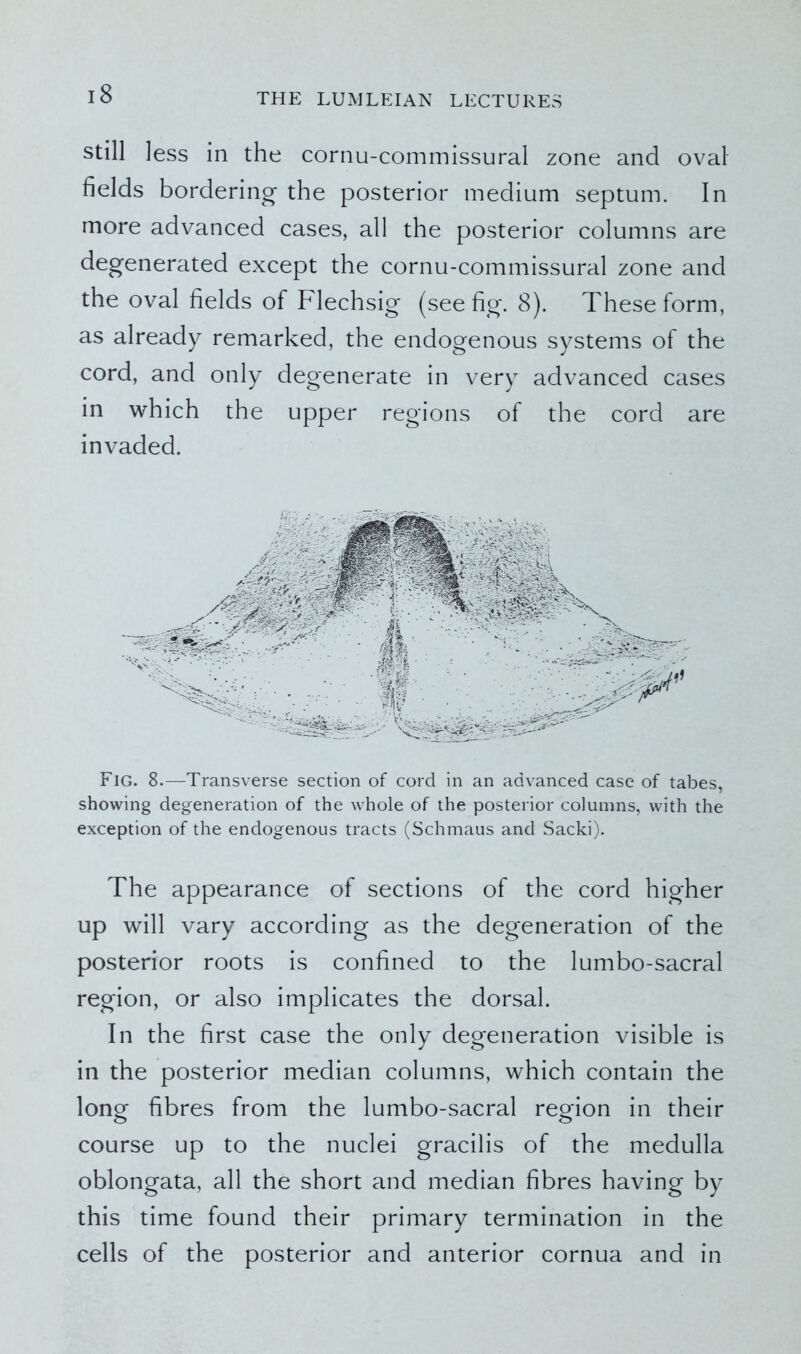 still less in the cornu-commissural zone and oval fields bordering the posterior medium septum. In more advanced cases, all the posterior columns are degenerated except the cornu-commissural zone and the oval fields of Flechsig (see fig. 8). These form, as already remarked, the endogenous systems of the cord, and only degenerate in very advanced cases in which the upper regions of the cord are invaded. Fig. 8.—Transverse section of cord in an advanced case of tabes, showing degeneration of the whole of the posterior columns, with the exception of the endogenous tracts (Schmaus and Sacki). The appearance of sections of the cord higher up will vary according as the degeneration of the posterior roots is confined to the lumbo-sacral region, or also implicates the dorsal. In the first case the only degeneration visible is in the posterior median columns, which contain the long fibres from the lumbo-sacral region in their course up to the nuclei gracilis of the medulla oblongata, all the short and median fibres having by this time found their primary termination in the cells of the posterior and anterior cornua and in