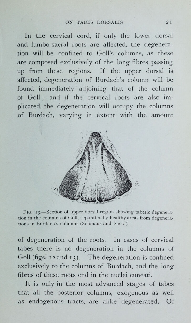 In the cervical cord, if only the lower dorsal and lumbo-sacral roots are affected, the degenera- tion will be confined to Golfs columns, as these are composed exclusively of the long fibres passing up from these regions. If the upper dorsal is affected, degeneration of Burdach’s column will be found immediately adjoining that of the column of Goll ; and if the cervical roots are also im- plicated, the degeneration will occupy the columns of Burdach, varying in extent with the amount Fig. 13.—Section of upper dorsal region showing tabetic degenera- tion in the columns of Goll, separated by healthy areas from degenera- tions in Burdach’s columns (Schmaus and Sacki). of degeneration of the roots. In cases of cervical tabes there is no degeneration in the columns of Goll (figs. 12 and 13). The degeneration is confined exclusively to the columns of Burdach, and the long fibres of these roots end in the nuclei cuneati. It is only in the most advanced stages of tabes that all the posterior columns, exogenous as well as endogenous tracts, are alike degenerated. Of