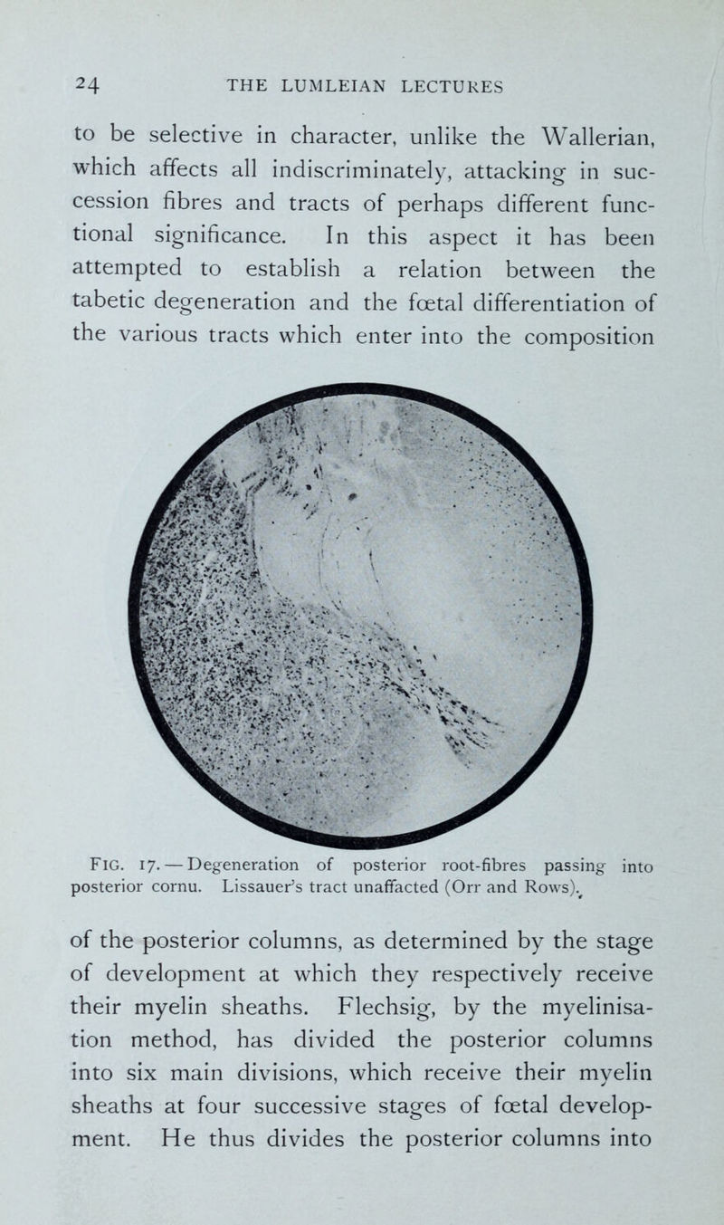 to be selective in character, unlike the Wallerian, which affects all indiscriminately, attacking in suc- cession fibres and tracts of perhaps different func- tional significance. In this aspect it has been attempted to establish a relation between the tabetic degeneration and the foetal differentiation of the various tracts which enter into the composition Fig. i7. — Degeneration of posterior root-fibres passing into posterior cornu. LissaueFs tract unafifacted (Orr and Rows).# of the posterior columns, as determined by the stage of development at which they respectively receive their myelin sheaths. Flechsig, by the myelinisa- tion method, has divided the posterior columns into six main divisions, which receive their myelin sheaths at four successive stages of foetal develop- ment. He thus divides the posterior columns into