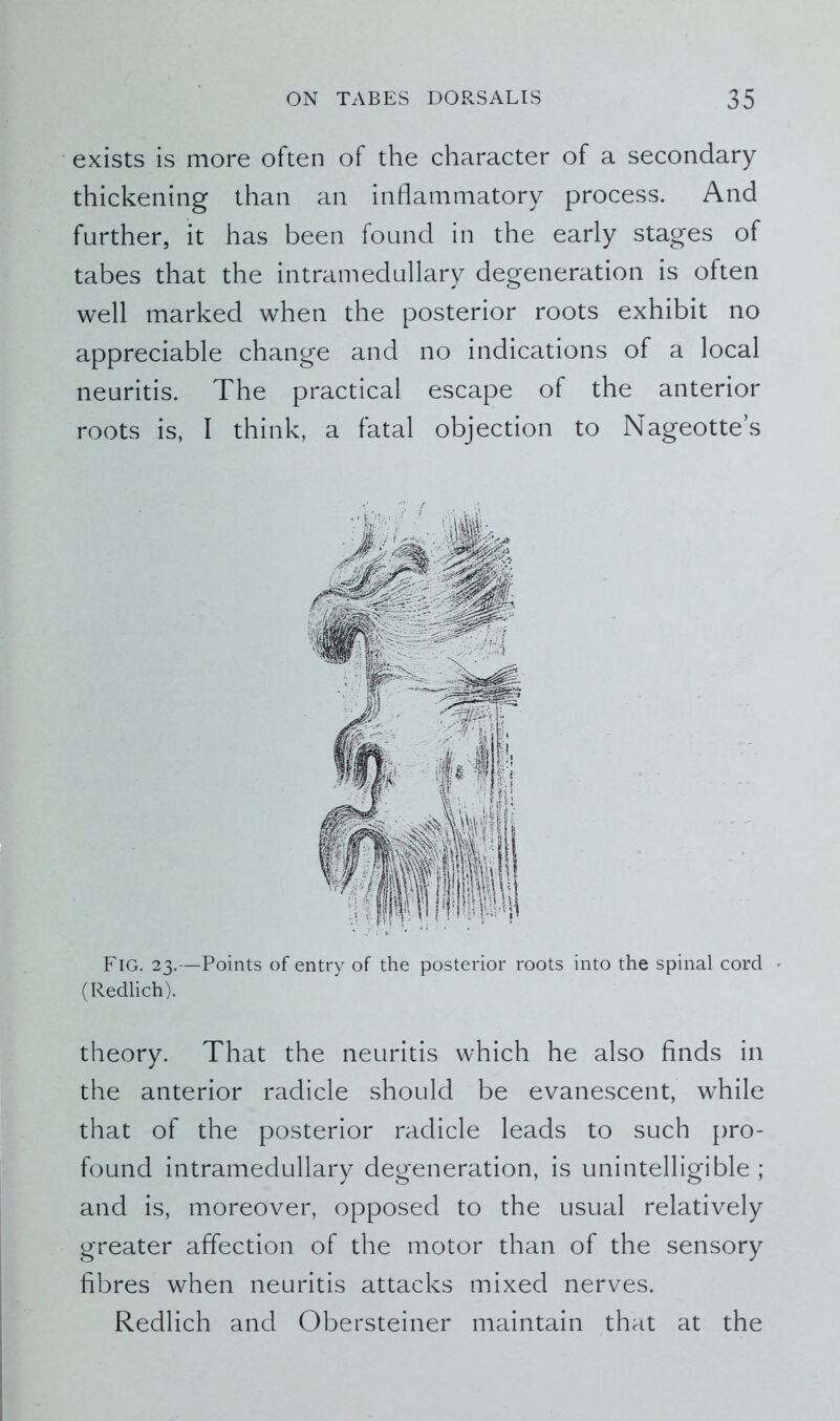 exists is more often of the character of a secondary thickening than an inflammatory process. And further, it has been found in the early stages of tabes that the intramedullary degeneration is often well marked when the posterior roots exhibit no appreciable change and no indications of a local neuritis. The practical escape of the anterior roots is, I think, a fatal objection to Nageotte’s Fig. 23.—Points of entry of the posterior roots into the spinal cord - (Redlich). theory. That the neuritis which he also finds in the anterior radicle should be evanescent, while that of the posterior radicle leads to such pro- found intramedullary degeneration, is unintelligible ; and is, moreover, opposed to the usual relatively greater affection of the motor than of the sensory fibres when neuritis attacks mixed nerves. Redlich and Obersteiner maintain that at the