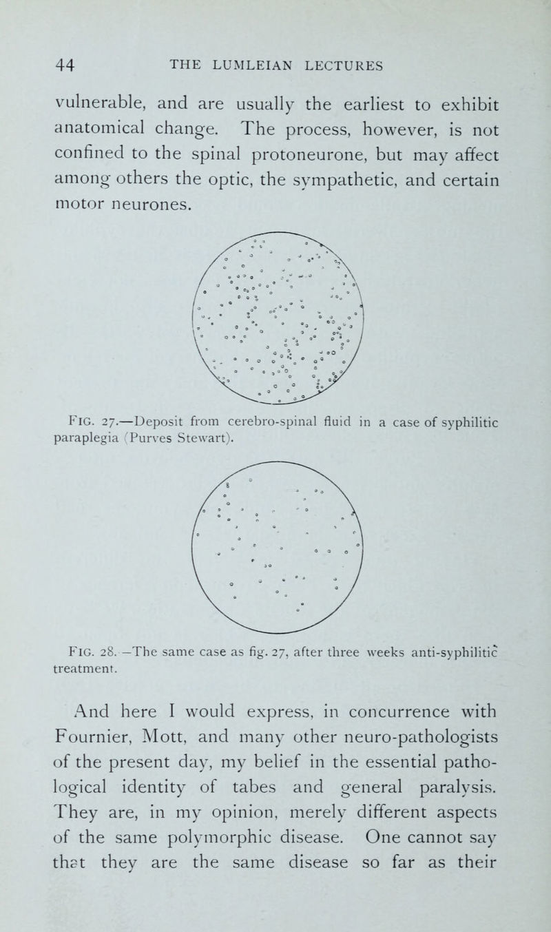 vulnerable, and are usually the earliest to exhibit anatomical change. The process, however, is not confined to the spinal protoneurone, but may affect among others the optic, the sympathetic, and certain motor neurones. Fig. 27.—Deposit from cerebro-spinal fluid in a case of syphilitic paraplegia (Purves Stewart). Fig. 28. —The same case as fig. 27, after three weeks anti-syphilitic treatment. And here I would express, in concurrence with Fournier, Mott, and many other neuro-pathologists of the present day, my belief in the essential patho- logical identity of tabes and general paralysis. They are, in my opinion, merely different aspects of the same polymorphic disease. One cannot say that they are the same disease so far as their