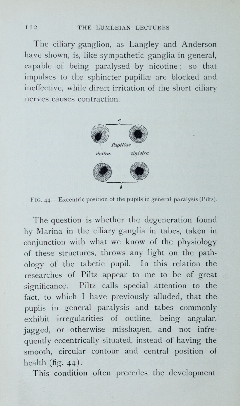 The ciliary ganglion, as Langley and Anderson have shown, is, like sympathetic ganglia in general, capable of being paralysed by nicotine ; so that impulses to the sphincter pupillae are blocked and ineffective, while direct irritation of the short ciliary nerves causes contraction. FlG. 44.—Excentric position of the pupils in general paralysis (Piltz). The question is whether the degeneration found by Marina in the ciliary ganglia in tabes, taken in conjunction with what we know of the physiology of these structures, throws any light on the path- ology of the tabetic pupil. In this relation the researches of Piltz appear to me to be of great significance. Piltz calls special attention to the fact, to which I have previously alluded, that the pupils in general paralysis and tabes commonly exhibit irregularities of outline, being angular, jagged, or otherwise misshapen, and not infre- quently eccentrically situated, instead of having the smooth, circular contour and central position of health (fig. 44). This condition often precedes the development