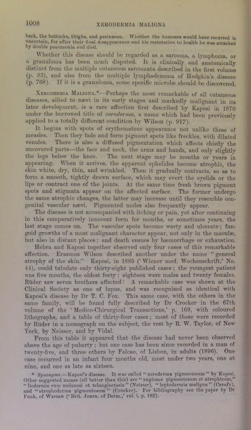 XERODERMIA MALIGNA back, the buttocks, tliighs, iiiul periiucuui. Wlietlier tlie tumours would have recurred is uiicertHiu, for after their Huai disappearance and Ids restoralioii to liealth he was attacked l>y double pneumonia and »iied. Whether this diseuse should be regurded us a sarcoma, a lymphoma, or a granuloma has been much disputed. It is clinically and anatomically distinct from tho multiple cutaneous sarcomata described in the first volume (p. 83), and also from tho multiple lymplmdenoma of Hodgkin’s disease (p. 768). If it is a granuloma, some specific microbe should l>e discovered. Xekoueumia Maligna.*—Perhaps the most remarkable of all cutaneous diseases, allied to nsevi in its early stages and markedly malignant in its later develoiuuent, is a rare affection first described by Kaposi in 1870 undei the boiioued title of xcvodtriHii-j a name which had been previously applied to a totally different condition by Wilson (p. 917). It begins with spots of erythematous appearance not unlike those of measles. Tlien they fade and form pigment spots like freckles, with dilated venules. There is also a diffused pigmentation which affects chiefly the uncovered parts—the face and neck, the arms and hands, and only slightly the legs below the knee. The next stage may be months or years in appearing. When it arrives, the ajiparent ephelides become atrophic, the skin white, dry, thin, and wrinkled. Then it gradually contracts, so as to form a smooth, tightly drawm surface, which may evert the eyelids or the lips or contract one of the joints. At the same time fresh bro^vn pigment spots and stigmata appear on the affected surface. The former undergo the same atrophic changes, the latter may increase until they resemble con- genital vascular mevi. Pigmented moles also frequentl}’- appear. The disease is not accomiianied with itching or pain, yet after continuing in this comparatively innocent form for months, or sometimes years, the last stage comes on. The vascular spots become warty and ulcerate; fun- goid growths of a most malignant character appear, not only in the maculae, but also in distant places; and death ensues by haemorrhage or exhaustion. Hebra and Kaposi together observed only four cases of this remarkable affection. Erasmus Wilson described another under the name “ general atrophy of the skin.” Kaposi, in 1885 (‘ Wiener med. Wochenschrift,’ Ko. 44), could tabulate only thirty-eight published cases; the youngest patient was five months, the oldest forty j eighteen were males and twenty females. Riider saw seven brothers affected! A remarkable case was shown at the Clinical Society as one of lupus, and was recognised as identical with Kaposi’s disease by Dr T. C. Fox. This same case, with the others in the same family, will be found fully described by Dr Crocker in the 67th volume of the ‘ Medico-Chirurgical Transactions,’ p. 169, with coloured lithographs, and a table of thirty-four cases; most of these were recorded by Riider in a monograph on the subject, the rest by R. W. Taylor, of New York, by Neisser, and by Vidal. From this table it appeared that the disease had never been observed above the age of puberty; but one case has been since recorded in a man of twenty-five, and three others by Falcao, of Lisbon, in adults (1896). One case occurred in an infant four months old, most under two years, one at nine, and one as late as sixteen. * Synoni/mx.— Kaposi’s disease. It was called “ xeroderma pigmentosum ” by Kaiiosi. Other suggested names (nil better than this) are “ angioma pigmentosum et atrophiciim,” “liodermia cum melanosi et telangiectasia” (Neisser), “leptodermia maligna” (Cavafy), and “atrophoderma pigmentosum” (Crocker). For bibliography see the paper by Dr Funk, of Warsaw (‘Brit. Journ. of Derm.,’ vol. i, p. 182).