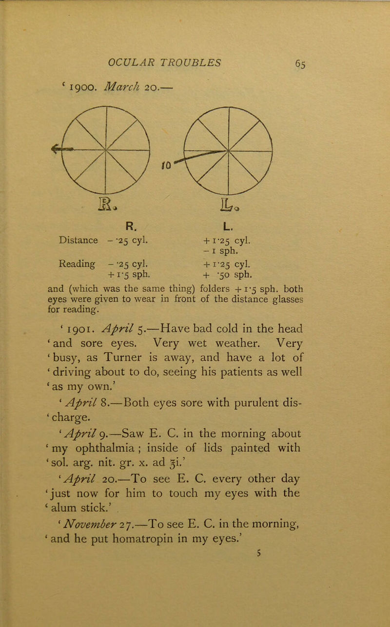 ‘ 1900. March 20.— R. Distance - '25 cyl. + i‘2K cyl. - I sph. L. Reading - '25 cyl. + 1-5 sph. +1-25 cyl. + -50 sph. and (which was the same thing) folders +i'5 sph. both eyes were given to wear in front of the distance glasses for reading. ‘ 1901. April 5.—Have bad cold in the head ‘and sore eyes. Very wet weather. Very ‘busy, as Turner is away, and have a lot of ‘ driving about to do, seeing his patients as well ‘ as my own.’ ‘ April 8.—Both eyes sore with purulent dis- ‘ charge. ' April —Saw E. C. in the morning about ‘ my ophthalmia ; inside of lids painted with ‘ sol. arg. nit. gr. x. ad ^i.’ 'April 20.—To see E. C. every other day ‘just now for him to touch my eyes with the ‘ alum stick.’ ‘ November 2^.—To see E. C. in the morning, ‘ and he put homatropin in my eyes.’ 5
