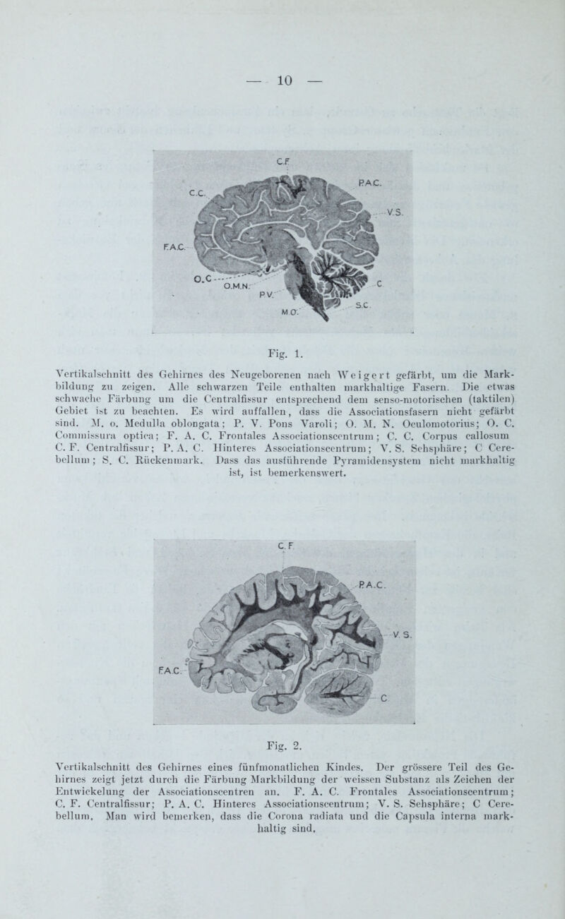 Fig. 1. Vertikalschnitt des Gehirnes des Neugeborenen nach Weigert gefärbt, um die Mark- bildung zu zeigen. Alle schwarzen Teile enthalten inarkhaltige Fasern. Die etwas schwache Färbung um die Centralfissur entsprechend dem senso-ruotorischen (taktilen) Gebiet ist zu beachten. Es wird auffallen, dass die Associationsfasern nicht gefärbt sind. M. o. Medulla obloDgata; P. V. Pons Varoli; O. M. N. Oculomotorius; O. C. Commissura optica; F. A. C. Frontales Associationscentrum; C. C. Corpus callosum C. F. Centralfissur; P. A. C. Hinteres Associationscentrum; V. S. Sehsphäre; C Cere- bellum ; S. C. Rückenmark. Dass das ausluhrende Pyramidensystem nicht markhaltig ist, ist bemerkenswert. CF Fig. 2. Vertikalschnitt des Gehirnes eines fünfmonatlichen Kindes. Der grössere Teil des Ge- hirnes zeigt jetzt durch die Färbung Markbilduug der weissen Substanz als Zeichen der Entwickelung der Associationscentren an. F. A. C. Frontales Associationscentrum; C. F. Centralfissur; P. A. C. Hinteres Associationscentrum; V. S. Sehsphäre; C Cere- bellum. Man wird bemerken, dass die Corona radiata und die Capsula ipterna mark- haltig sind.