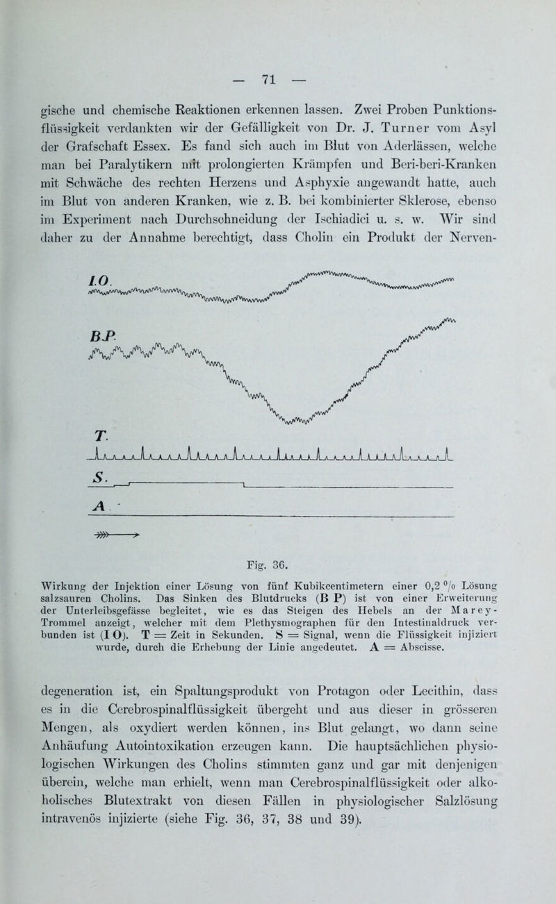 gische und chemische Reaktionen erkennen lassen. Zwei Proben Punktions- flüssigkeit verdankten wir der Gefälligkeit von Dr. J. Turner vom Asyl der Grafschaft Essex. Es fand sich auch im Blut von Aderlässen, welche man bei Paralytikern mH prolongierten Krämpfen und Beri-beri-Kranken mit Schwäche des rechten Herzens und Asphyxie angewandt hatte, auch im Blut von anderen Kranken, wie z. B. bei kombinierter Sklerose, ebenso im Experiment nach Durchsohneidung der Ischiadici u. s. w. Wir sind daher zu der Annahme berechtigt, dass Cholin ein Produkt der Nerven- 10 s. -m- Fig. 36. Wirkung der Injektion einer Lösung von fünf Kubikcentimetern einer 0,2 °/o Lösung salzsauren Cholins. Das Sinken des Blutdrucks (B P) ist von einer Erweiterung der Unterleibsgefässe begleitet, wie es das Steigen des Hebels an der Marey- Trommel anzeigt, welcher mit dem Plethysmographen für den Intestinaldruck ver- bunden ist (I O). T — Zeit in Sekunden. S = Signal, wenn die Flüssigkeit injiziert wurde, durch die Erhebung der Linie angedeutet. A = Abscisse. degeneration ist, ein Spaltungsprodukt von Protagon oder Lecithin, dass es in die Cerebrospinalflüssigkeit übergeht und aus dieser in grösseren Mengen, als oxydiert werden können, ins Blut gelangt, wo dann seine Anhäufung Autointoxikation erzeugen kann. Die hauptsächlichen physio- logischen Wirkungen des Cholins stimmten ganz und gar mit denjenigen überein, welche man erhielt, wenn man Cerebrospinalflüssigkeit oder alko- holisches Blutextrakt von diesen Fällen in physiologischer Salzlösung intravenös injizierte (siehe Fig. 36, 37, 38 und 39).