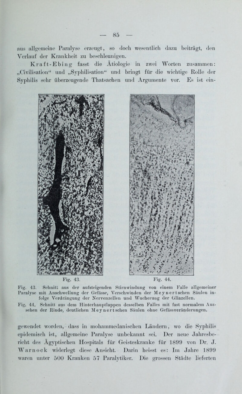 aus allgemeine Paralyse erzeugt, so doch wesentlich dazu beiträgt, den Verlauf der Krankheit zu beschleunigen. Kraft-Ebing fasst die Ätiologie in zwei Worten zusammen: „Civilisation“ und „Syphilisation“ und bringt für die wichtige Rolle der Syphilis sehr überzeugende Thatsachen und Argumente vor. Es ist ein- Fig. 43. Fig. 44. Fig. 43. Schnitt aus der aufsteigenden Stirnwindung von einem Falle allgemeiner Paralyse mit Anschwellung der Gefässe, Verschwinden der Meynertsehen Säulen in- folge Verdrängung der Nervenzellen und Wucherung der Gliazellen. Fig. 44. Schnitt aus dem Hinterhauptlappen desselben Falles mit fast normalem Aus- sehen der Rinde, deutlichen Meynert sehen Säulen ohne Gefässveränderungen. gewendet worden, dass in mohammedanischen Ländern, wo die Syphilis epidemisch ist, allgemeine Paralyse unbekannt sei. Der neue Jahresbe- richt des Ägyptischen Hospitals für Geisteskranke für 1899 von Dr. J. Warnock widerlegt diese Ansicht. Darin heisst es: Im Jahre 1899 waren unter 500 Kranken 57 Paralytiker. Die grossen Städte lieferten