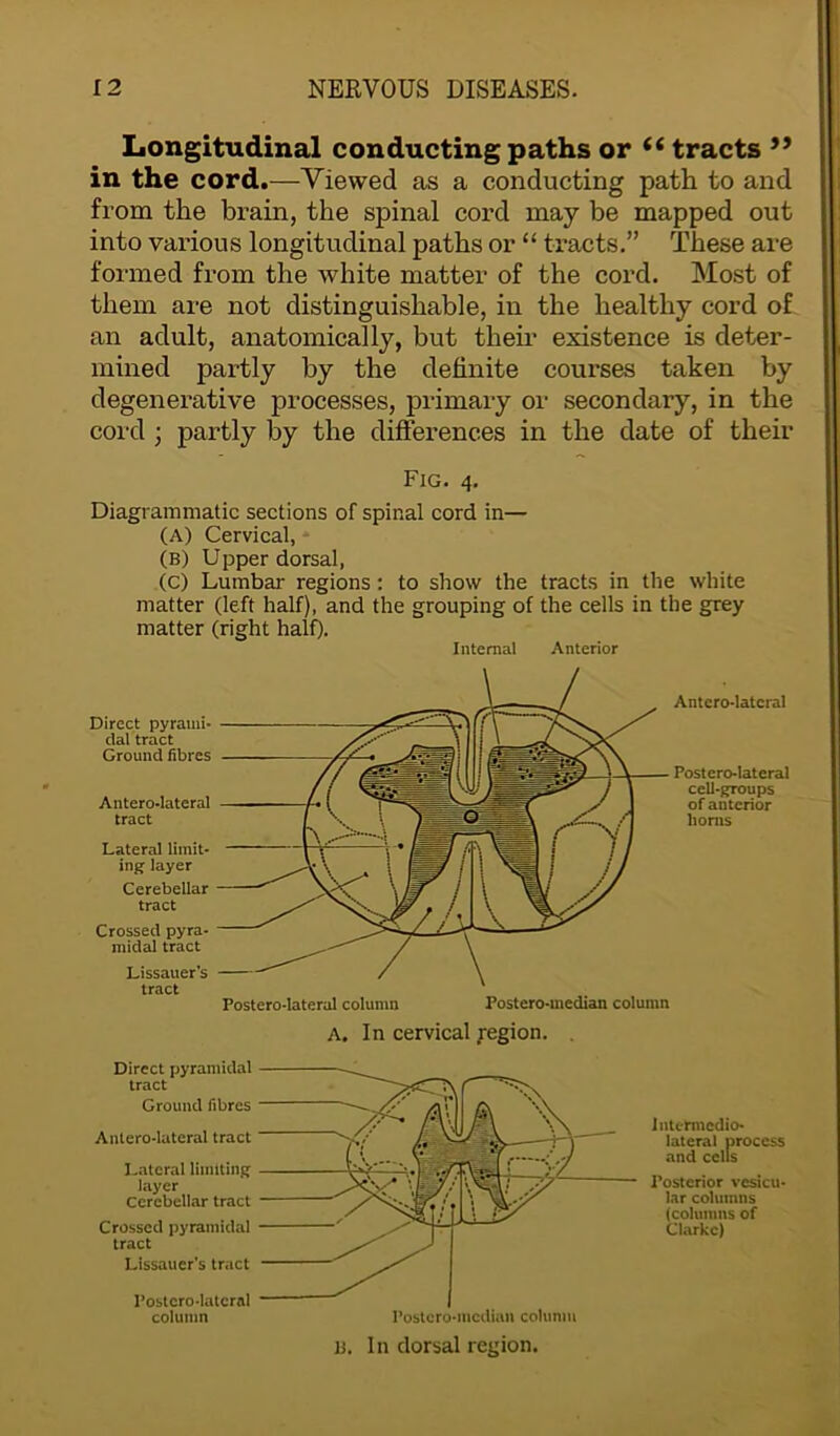 Longitudinal conducting paths or (i tracts 99 in the cord.—Viewed as a conducting path to and from the brain, the spinal cord may be mapped out into various longitudinal paths or “ tracts.” These are formed from the white matter of the cord. Most of them are not distinguishable, in the healthy cord of an adult, anatomically, but their existence is deter- mined partly by the definite courses taken by degenerative processes, primary or secondary, in the cord ; partly by the diffei’ences in the date of their Fig. 4. Diagrammatic sections of spinal cord in— (A) Cervical, (b) Upper dorsal, (c) Lumbar regions: to show the tracts in the white matter (left half), and the grouping of the cells in the grey matter (right half). Internal Anterior Direct pyrami- dal tract Ground fibres Antero-lateral tract Lateral limit- ing layer Cerebellar tract Crossed pyra- midal tract Postero-lateral column Postero-median column Antero-lateral Postero-lateral cell-groups of anterior horns A. In cervical region. Direct pyramidal tract Ground fibres Antero-lateral tract Lateral limiting layer Cerebellar tract Crossed pyramidal tract Lissauer's tract Postero-lateral column Postero-median column InU-rmedio- lateral process and cells Posterior vesicu- lar columns (columns of Clarke) B. In dorsal region.