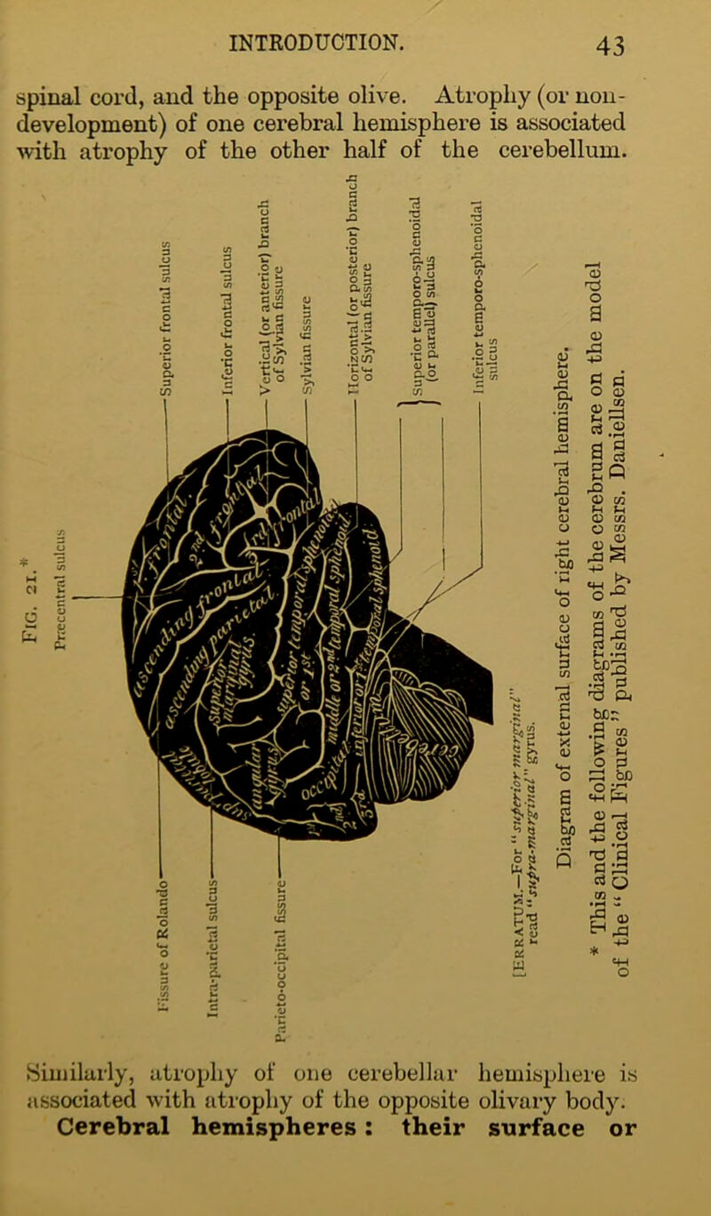 spinal cord, and the opposite olive. Atrophy (or non- development) of one cerebral hemisphere is associated with atrophy of the other half of the cerebellum. .c o 3 a- Similarly, atrophy of one cerebellar hemisphere is associated with atrophy of the opposite olivary body. Cerebral hemispheres : their surface or