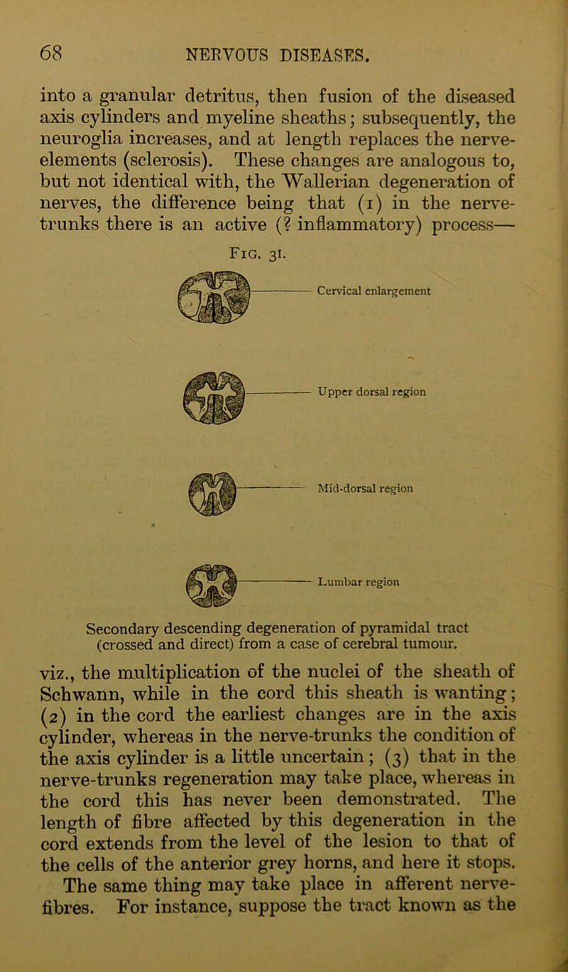 into a granular detritus, then fusion of the diseased axis cylinders and myeline sheaths; subsequently, the neuroglia increases, and at length replaces the nerve- elements (sclerosis). These changes are analogous to, but not identical with, the Wallerian degeneration of nerves, the difference being that (i) in the nerve- trunks there is an active (? inflammatory) process— Fig. 31. Cervical enlargement Upper dorsal region Mid-dorsal region Lumbar region Secondary descending degeneration of pyramidal tract (crossed and direct) from a case of cerebral tumour. viz., the multiplication of the nuclei of the sheath of Schwann, while in the cord this sheath is wanting; (2) in the cord the earliest changes are in the axis cylinder, whereas in the nerve-trunks the condition of the axis cylinder is a little uncertain; (3) that in the nerve-trunks regeneration may take place, whereas in the cord this has never been demonstrated. The length of fibre affected by this degeneration in the cord extends from the level of the lesion to that of the cells of the anterior grey horns, and here it stops. The same thing may take place in afferent nerve- fibres. For instance, suppose the tract known as the