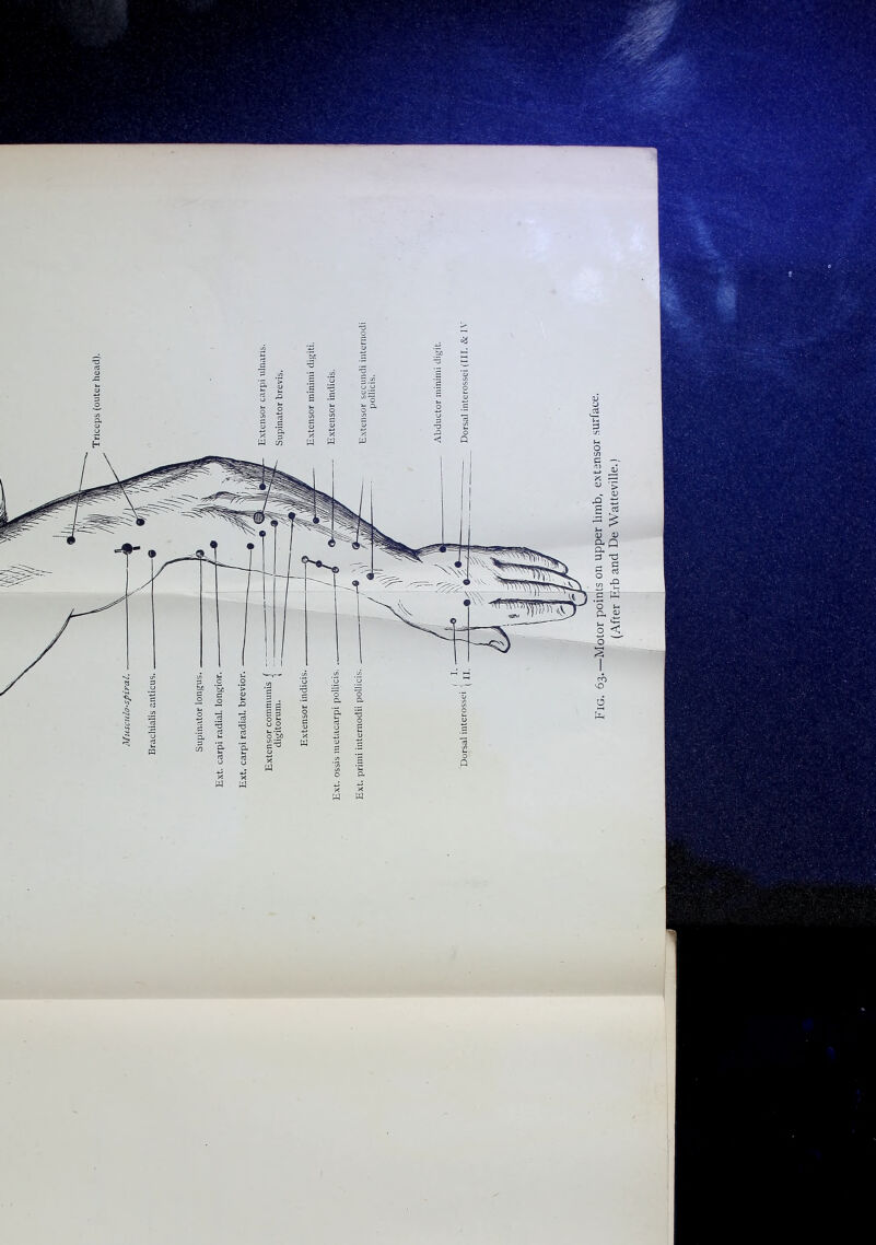 Brachialis anticus.