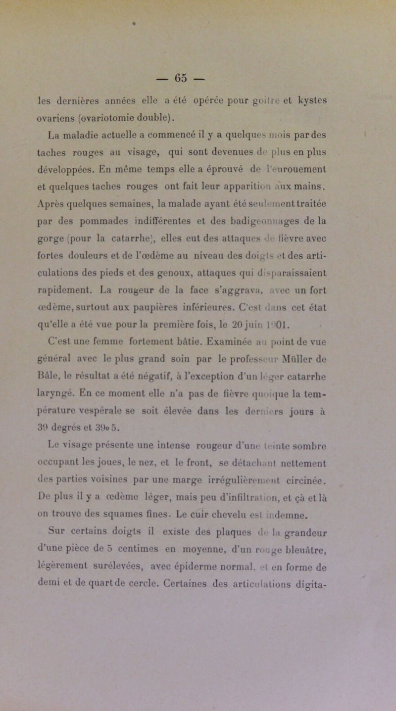 les dernières années elle a été opérée pour goitre et kystes ovariens (ovariotomie double). La maladie actuelle a commencé il y a quelquo mois par des taches rouges au visage, qui sont devenues de plus en plus développées. En même temps elle a éprouvé de l’> urouemenl et quelques taches rouges ont fait leur apparition aux mains. Après quelques semaines, la malade ayant été seulement traitée par des pommades indifférentes et des badigeonnages de la gorge (pour la catarrhe), elles eut des attaques •!' lièvre avec fortes douleurs et de l'œdème au niveau des doi.. ! - et des arti- culations des pieds et des genoux, attaques qui d -paraissaient rapidement. La rougeur de la face s’aggrava, avec un fort œdème,surtout aux paupières inférieures. C’est dans cet état qu’elle a été vue pour la première fois, le 20 juin 1 01. C’est une femme fortement bâtie. Examinée au point de vue général avec le plus grand soin par le profess* ir Müller de Bêle, le résultat a été négatif, à l’exception d’un loger catarrhe laryngé. En ce moment elle n’a pas de fièvre qu que la tem- pérature vespérale se soit élevée dans les dor rs jours à 39 degrés et 39o 5. Le visage présente une intense rougeur d’une teinte sombre occupant les joues, le nez, et le front, se détachant nettement des parties voisines par une marge irrégulièrement circinée. De plus il y a œdème léger, mais peu d’infiltration, et çà et là on trouve des squames fines. Le cuir chevelu esl indemne. Sur certains doigts il existe des plaques d- la grandeur d’une pièce de 5 centimes en moyenne, d’un ro îge bleuâtre, légèrement surélevées, avec épiderme normal, t en forme de demi et de quart de cercle. Certaines des articulations digita-