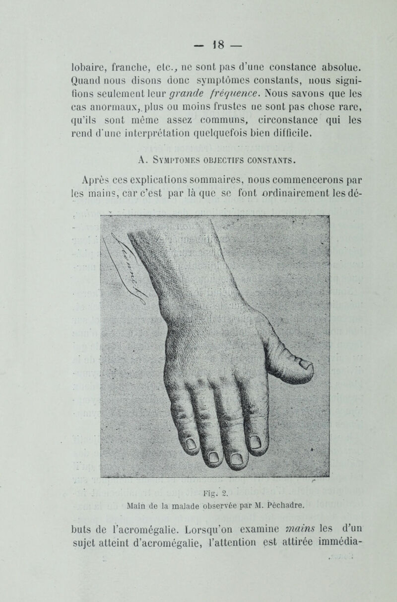 lobaire, franche, etc., ne sont pas d’une constance absolue. Quand nous disons donc symptômes constants, nous signi- fions seulement leur grande fréquence. Nous savons que les cas anormaux, plus ou moins frustes ne sont pas chose rare, qu’ils sont même assez communs, circonstance qui les rend d’une interprétation quelquefois bien difficile. A. Symptômes objectifs constants. Après ces explications sommaires, nous commencerons par les mains, car c’est par laque se font ordinairement les dé- Fig/2. Main de la maiade observée par M. Péchadre, buts de l’acromégalie. Lorsqu’on examine mains les d’un sujet atteint d’acromégalie, l’attention est attirée immédia-