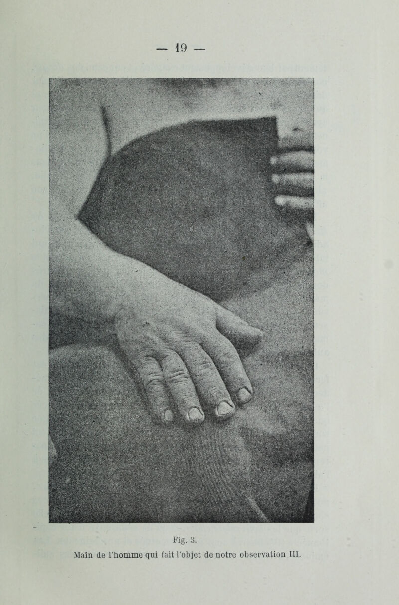 Fig. 3. Main de l’homme qui fait l’objet de notre observation III