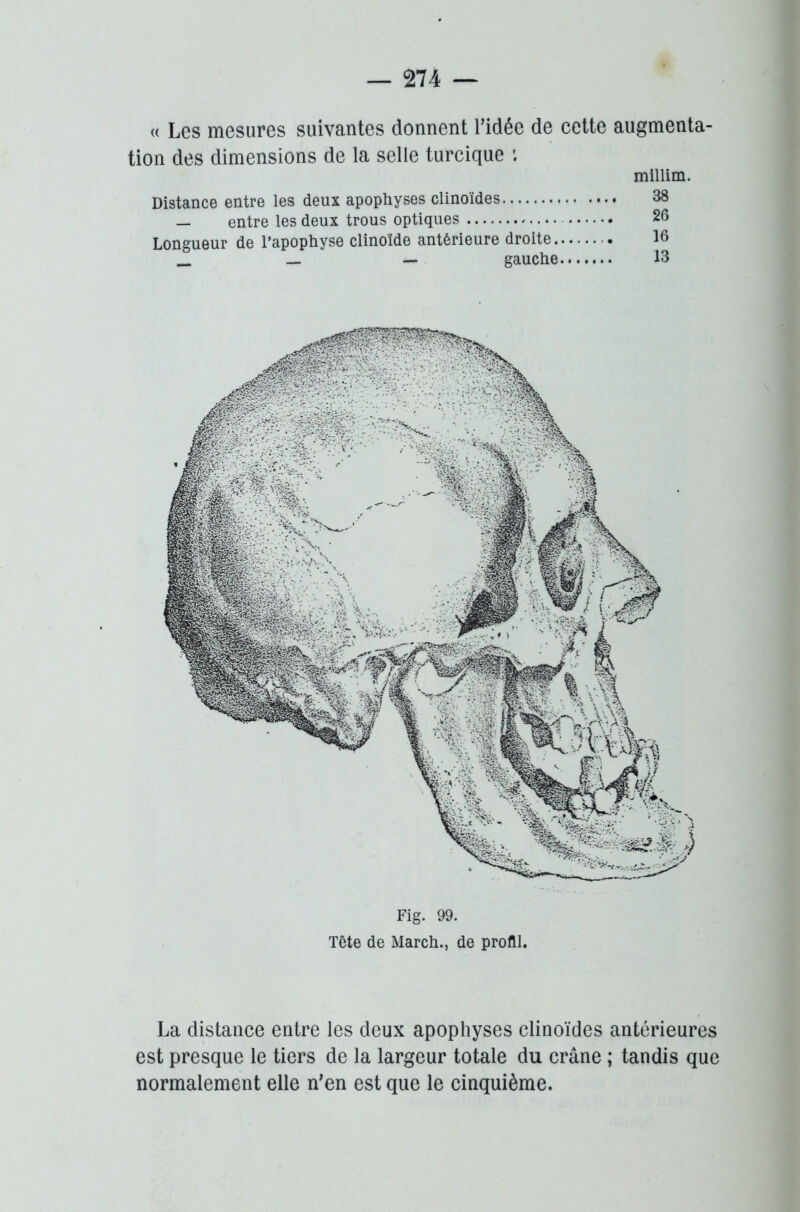 « Les mesures suivantes donnent l’idée de cette augmenta- tion des dimensions de la selle turcique ; millim. Distance entre les deux apophyses clinoïdes 38 — entre les deux trous optiques 26 Longueur de l’apophyse clinoïde antérieure droite 16 _ — — gauche -13 Fig. 99. Tête de March., de profil. La distance entre les deux apophyses clinoïdes antérieures est presque le tiers de la largeur totale du crâne ; tandis que normalement elle n'en est que le cinquième.