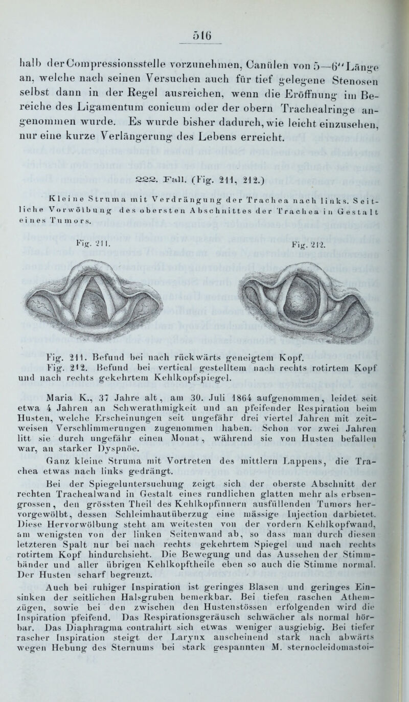 hall) (lerCoinpressionsstelle vorzimelinien, Canälen von 5—6''Län<>e an, welche nach seinen Versuchen auch für tief gelegene Stenosen selbst dann in der Regel ausreichen, wenn die Eröffnung im Be- reiche des Ligamentum conicum oder der obern Trachealringe an- genommen wurde. Es wurde bisher dadurch, wie leicht einzusehen, nur eine kurze Verlängerung des Lebens erreicht. 222. Fall. (Fig. 211, 212.) Kleine Struma mit Verdrängung der Trachea nach links. Seit- liche V o r w ö 1 b u n g des obersten Abschnittes der 1’ r a c h e a in Gestalt eines T u m o r s. Fig. ‘211, Fig.212. Flg. 211. Befund hei nach rückwärts geneigtem Kopf. Fig. 212. Befniid bei vertical gesteUteni nach reclit.s rotirtem Kopf und nacli rechts gekehrtem Kehlkopfspiegel. Maria K., 37 Jahre alt, am 30. Juli 1864 aufgenommen, leidet seit etwa 4 Jahren an Schwerathmigkeit und an pfeifender Respiration heim Husten, welciie Erscheinungen seit ungefähr drei viertel Jahren mit zeit- weisen Verschlimmerungen zugenommen haben. Schon vor zwei Jahren litt sie durch ungefähr einen Monat, während sie von Husten befallen war, an starker Dyspnoe. Ganz kleine Struma mit Vortreten des mittlern Lappens, die Tra- chea etwas nach links gedrängt. Bei der Spiegeluntersuchung zeigt sich der oberste Abschnitt der rechten Trachealwand in Gestalt eines rundlichen glatten mehr als erbsen- grossen , den grössten Theil des Kehlkopfinnern ausfüllenden Tumors her- vorgewölbt, dessen Schleimhautüberzug eine mässige Injection darbietet. Diese Hervor Wölbung steht am weitesten von der vordem Keblkopfwand, am wenigsten von der linken Seitenwand ab, so dass man durch diesen letzteren Spalt nur bei nach rechts gekehrtem Spiegel und nach rechts rotirtem Kopf hindurchsieht. Die Bewegung und das Aussehen der .Stimm- bänder und aller übrigen Kehlkopftheile eben so auch die Stimme normal. Der Husten scharf begrenzt. Auch bei ruhiger Inspiration ist geringes Blasen und geringes Ein- sinken der seitlichen Halsgruben bemerkbar. Bei tiefen raschen Athem- zügen, sowie bei den zwischen den Hustenstössen erfolgenden wird die Inspiration pfeifend. Das Respirationsgeräusch schwächer als normal hör- bar. Das Diaphragma contrahirt sich etwas weniger ausgiebig. Bei tiefer rascher Inspiration steigt der Lai’ynx anscheinend stark )iach abwärts wegen Hebung des Sternums bei stark gespannten M. sternocleidomastoi-