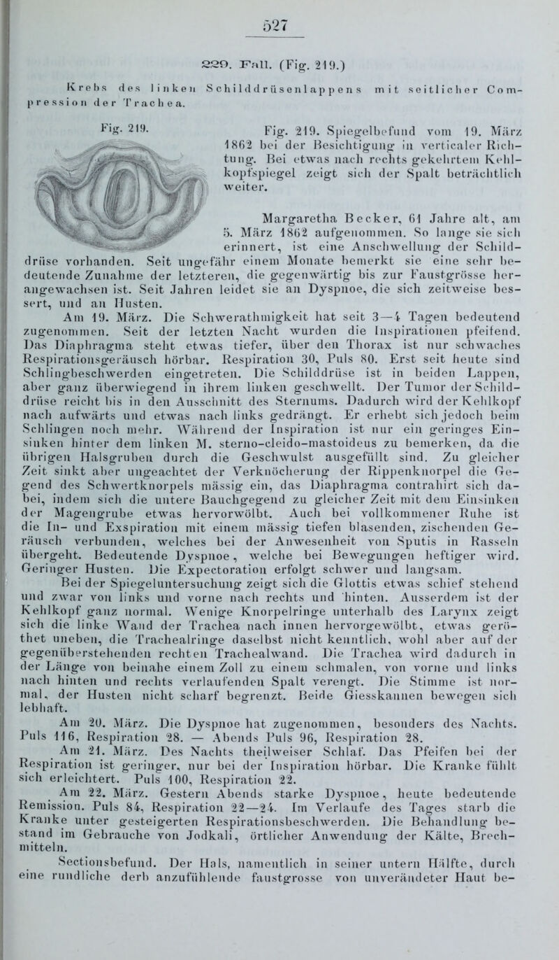 Ö27 220. Fall. (Fig*. 219.) Krebs des linken S c h i 1 d d r ü s e n 1 a p p e n s mit soitliclior Com- Fig. 219. Spiegelbofund vom 19. März 1802 hei der Besichtigung in verticaler Rich- tung. Bei etwas nacli rechts gekehrtem Kehl- kopfspiegel zeigt sich der Spalt heträchtlich weiter. Margaretha Becker, 01 Jahre alt, am o. März 1802 aufgenommen. So lange sie sich erinnert, ist eine Anschwellung der Schild- drüse vorhanden. Seit ungefähr einem Monate hemerkt sie eine selir he- cleutende Zunahme der letzteren, die gegenwärtig his zur Faiistgrösse her- angewachsen ist. Seit Jahren leidet sie an Dyspnoe, die sich zeitweise bes- sert, und an Husten. Am 19. März. Die Schwerathmigkeit hat seit .3 — i Tagen bedeutend zugenommen. Seit der letzten Nacht wurden die Inspirationen pfeifend. Das Diaphragma steht etwas tiefer, über den Thorax ist nur schwaches Respirationsg-eräusch hörbar. Respiration 30, Puls 80. Erst seit heute sind Schlingbeschwerden eingetreten. Die Schilddrüse ist in beiden Lappen, aber ganz überwiegend in ihrem linken geschwellt. Der Tumor der Schild- drüse reicht bis in den Ausschnitt des Sternums. Dadurch wird der Kehlkopf nach aufwärts und etwas nach links gedrängt. Er erhebt sich jedoch beim Schliiig’en noch mehr. Während der Inspiration ist nur ein geringes Ein- sinken hinter dem linken M. sterno-cleido-mastoideus zu bemerken, da die übrigen Halsgruben durch die Geschwulst ausgefüllt sind. Zu gleicher Zeit sinkt aber ungeachtet der Verknöcherung der Rippenknorpel die Ge- gend des Schwertknorpels mässig ein, das Diaphragmia contrahirt sich da- bei, indem sich die untere Bauchg'egend zu gleicher Zeit mit dem Einsinken der Magengrube etwas hervorwölbt. Auch bei vollkommener Ruhe ist die In- und Exspiration mit einem mässig tiefen blasenden, zischenden Ge- räusch verbunden, welches bei der Anwesenheit von Sputis in Rasseln übergeht. Bedeutende Dyspnoe, welche bei Bewegungen heftiger wird. Geringer Husten. Die Expectoration erfolgt schwer und langsam. Bel der Spiegeluntersuchung zeigt sich die Glottis etwas schief stehend und zwar von links und vorne nach rechts und hinten. Ausserdem ist der Kehlkopf ganz normal. Wenige Knorpelringe unterhalb des Larynx zeigt sich die linke Wand der Trachea nach innen hervorgewölbt, etwas gerf)- thet uneben, die Trachealringe daselbst nicht kenntlich, wohl aber auf der gegenüberstehenden rechten Trachealwand. Die Trachea wird dadurch in der Länge von beinahe einem Zoll zu einem schmalen, von vorne und links nach hinten und rechts verlaufenden Spalt verengt. Die Stimme ist nor- mal, der Husten nicht scliarf begrenzt. Beide Giesskannen bewegen sich lebhaft. Am 20. März. Die Dyspnoe hat zugenommen, besonders des Nachts. Puls 116, Respiration 28. — Abends Puls 96, Respiration 28. Am 21. März. Des Nachts theijweiser Schlaf. Das Pfeifen bei der Respiration ist g-eriiiger, nur bei der Inspiration hörbar. Die Kranke fühlt sich erleichtert. Puls 100, Respiration 22. Am 22. März. Gestern Abends starke Dyspnoe, heute bedeutende Remission. Puls 84, Respiration 22—24. Im Verlaufe des Tages starb die Kranke unter gesteigerten Respirationsbeschwerden. Die Behandlung be- stand im Gebrauche von Jodkali, örtlicher Anwendung der Kälte, Brech- mitteln. Sectionsbefund. Der Hals, namentlich in seiner untern Hälfte, durcli eine rundliclie derb anzufühlende faustgrosse von unverändeter Haut be- p r e .s s i o n d e r 'I' r a c h e a.